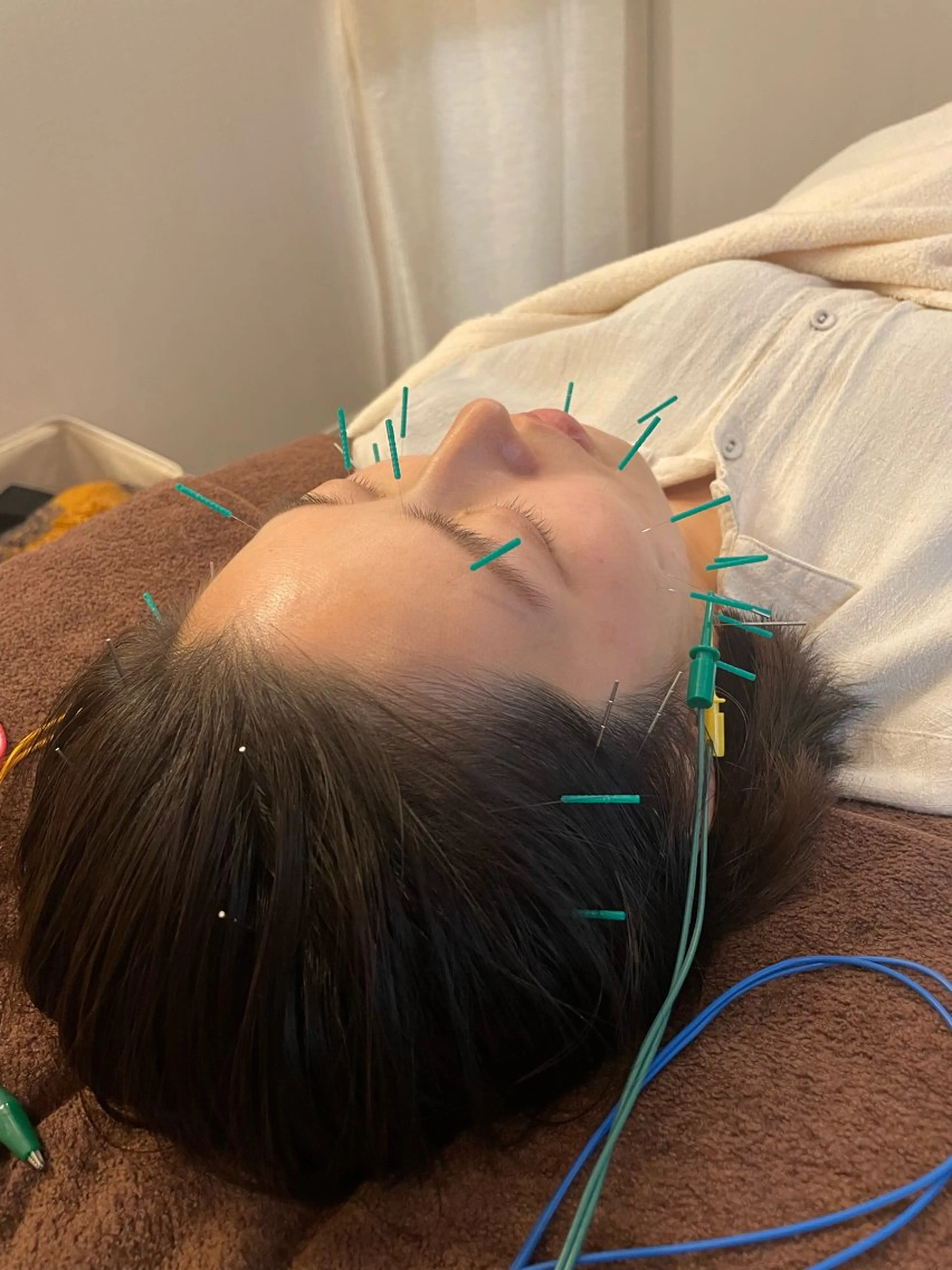 美容鍼　蒼月-aotsuki-所属・美容鍼「蒼月」 -アオツキ-のエステ・リラクイメージ