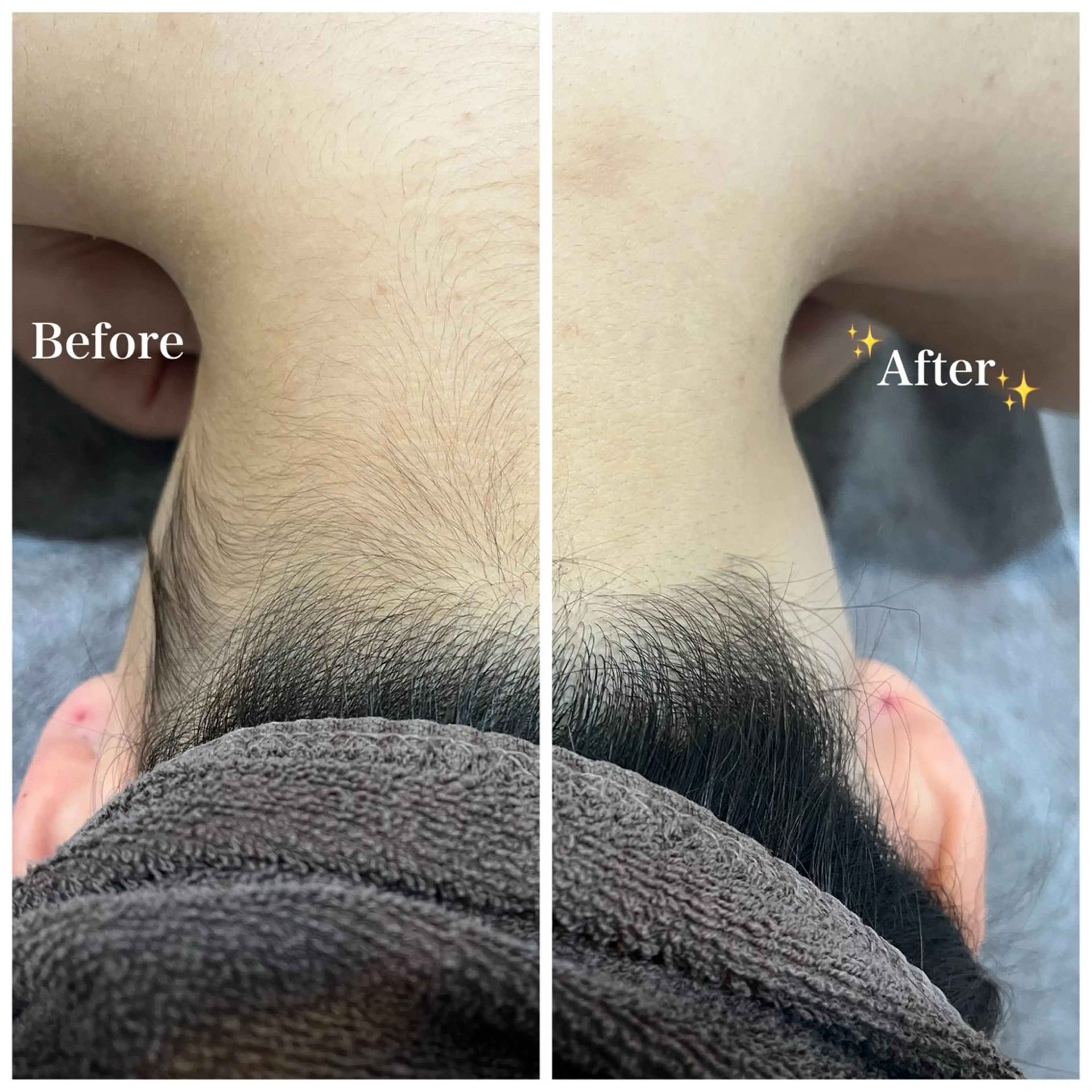 脱毛 脱毛サロン fam.豊澤柚良のエステ・リラクイメージ