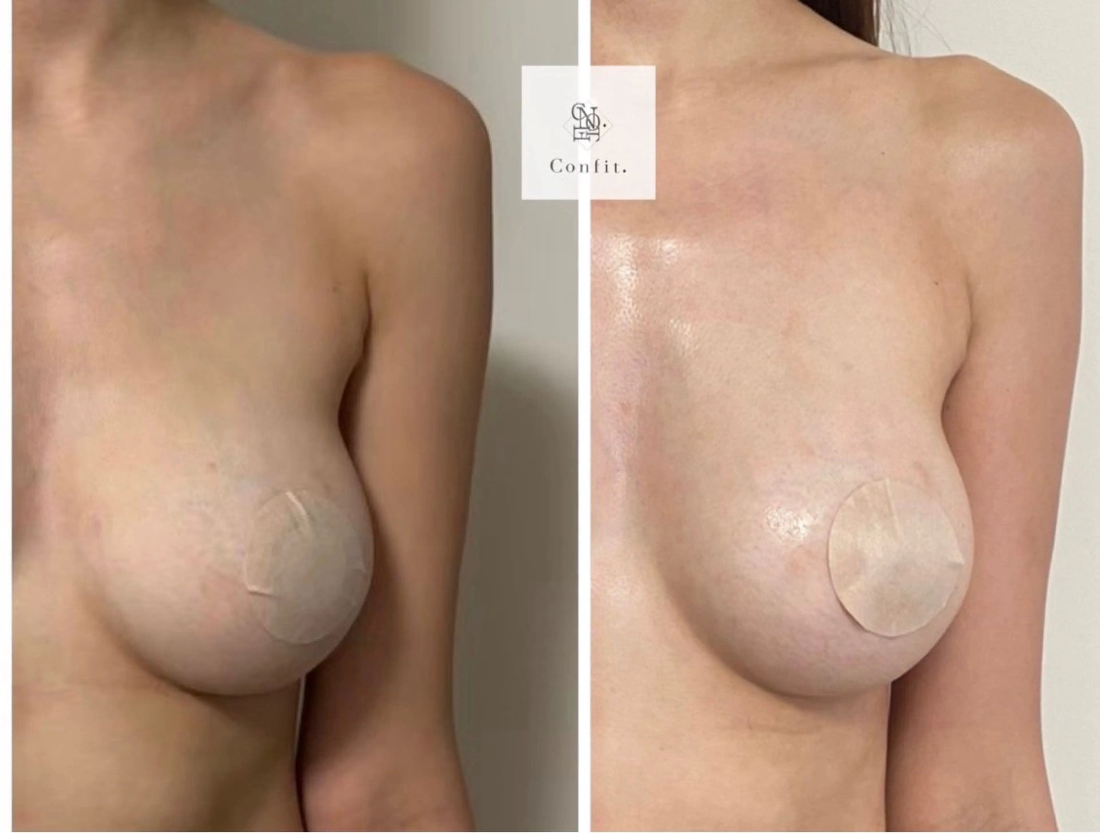 エステ 小顔/たるみ/黒ずみ除去専門サロン/SONA 大和西大寺店所属・【小顔痩身専門看護師 サロンSONA】のエステ・リラクイメージ