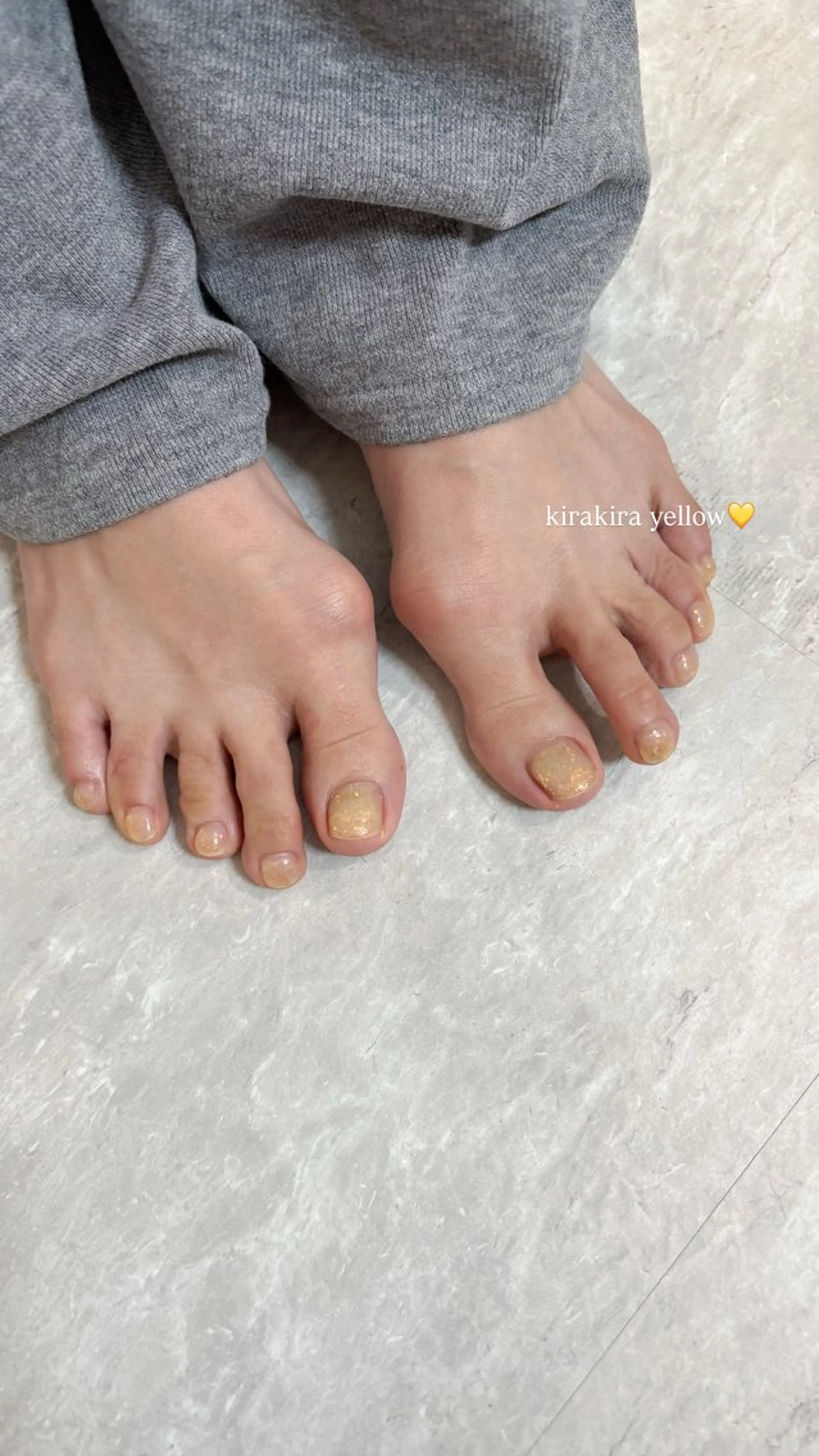 ネイル フットネイル liulu nailのネイルデザイン