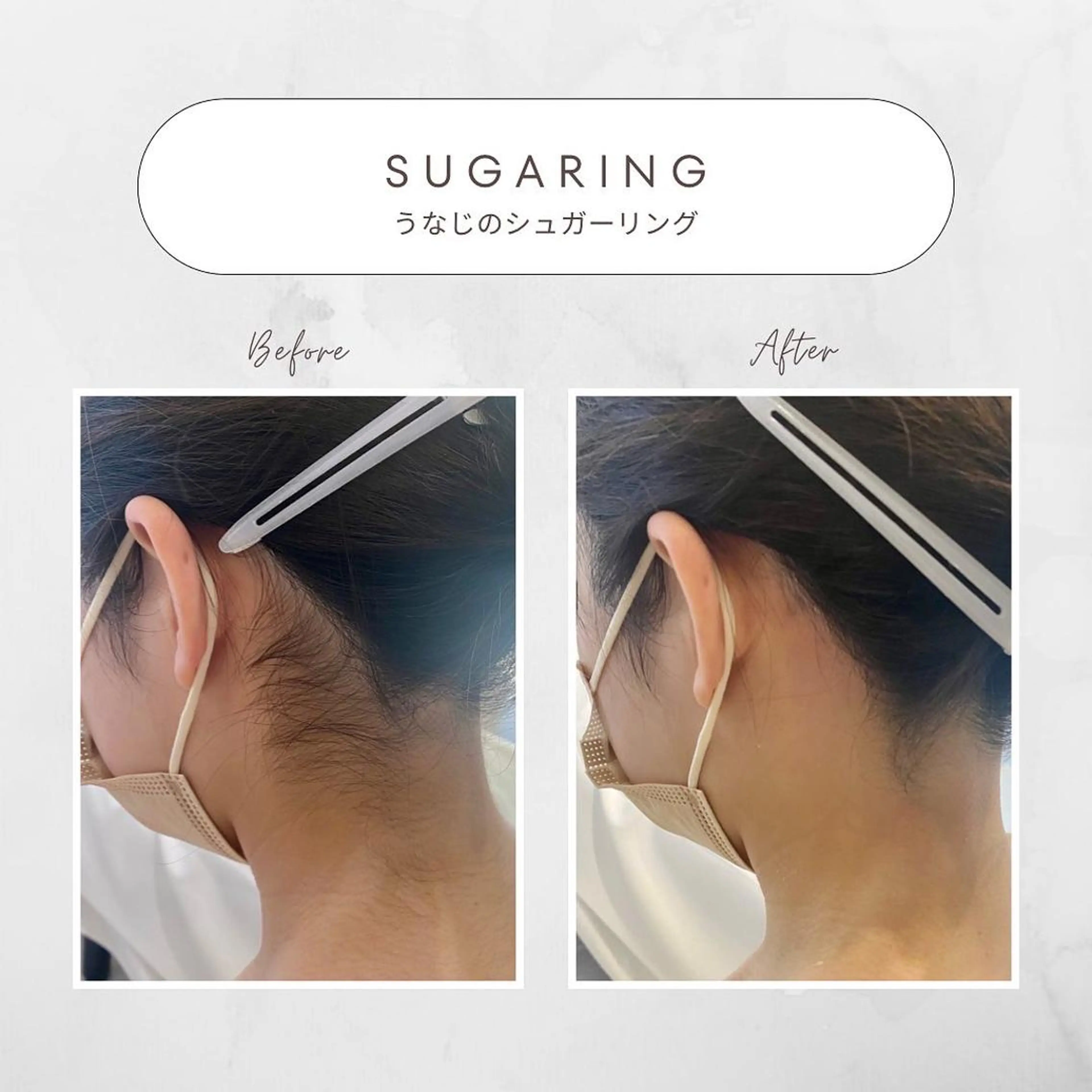 脱毛 Stella sugaringのエステ・リラクイメージ