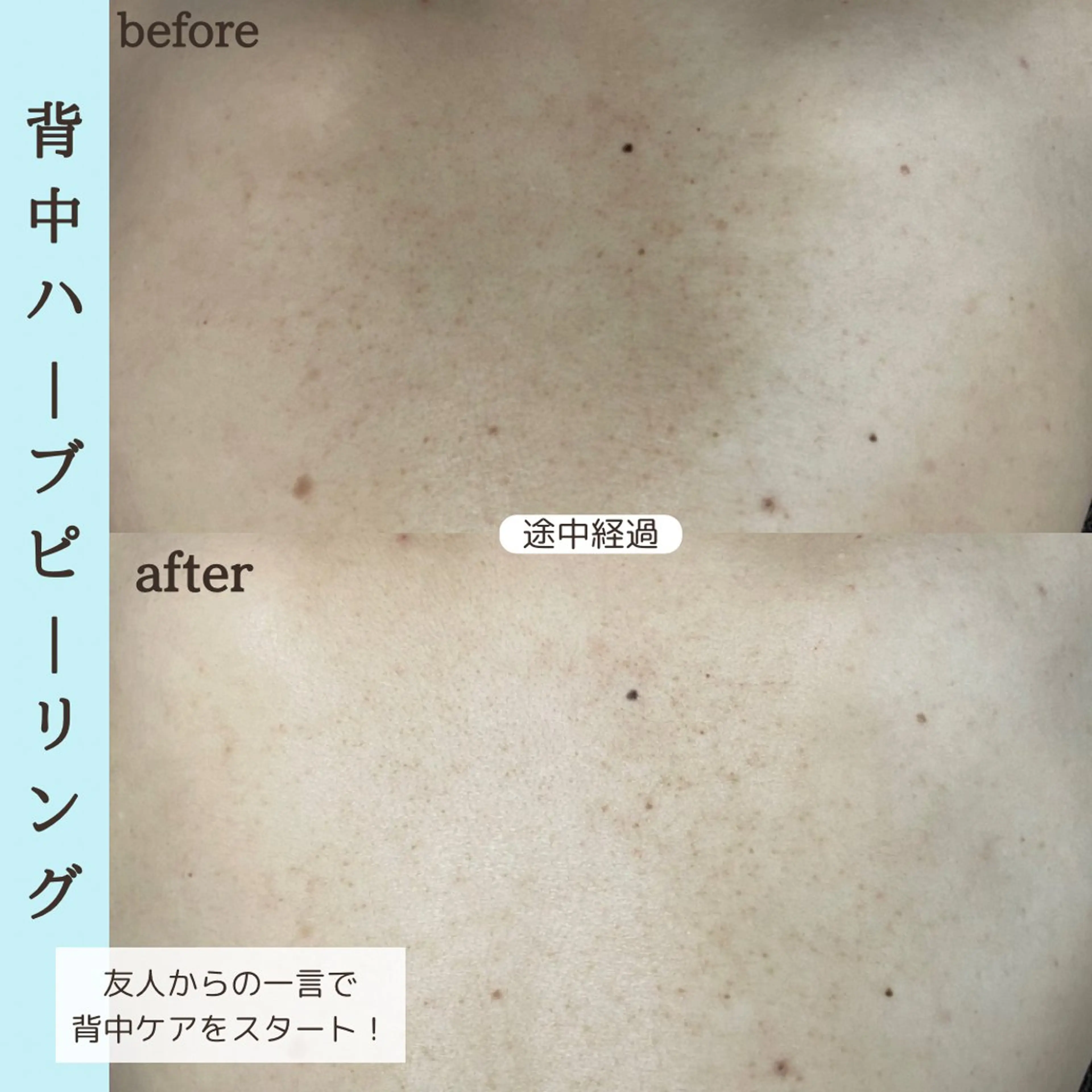 エステ ベラージュ【美背中・ 美尻・フェイシャル】のエステ・リラクイメージ