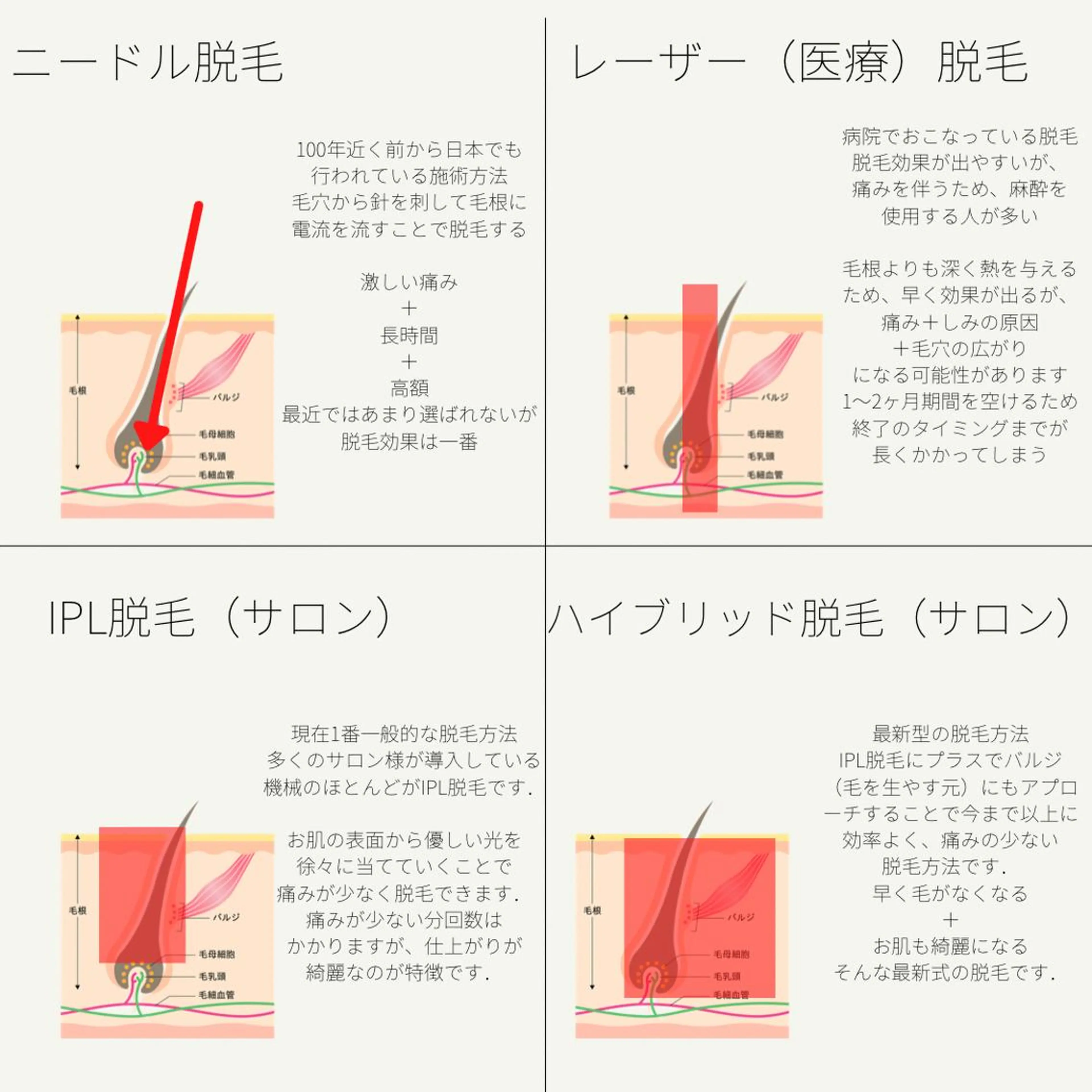 メンズ キッズ 男女同額完全個室脱毛 LEPIA内田のエステ・リラクイメージ