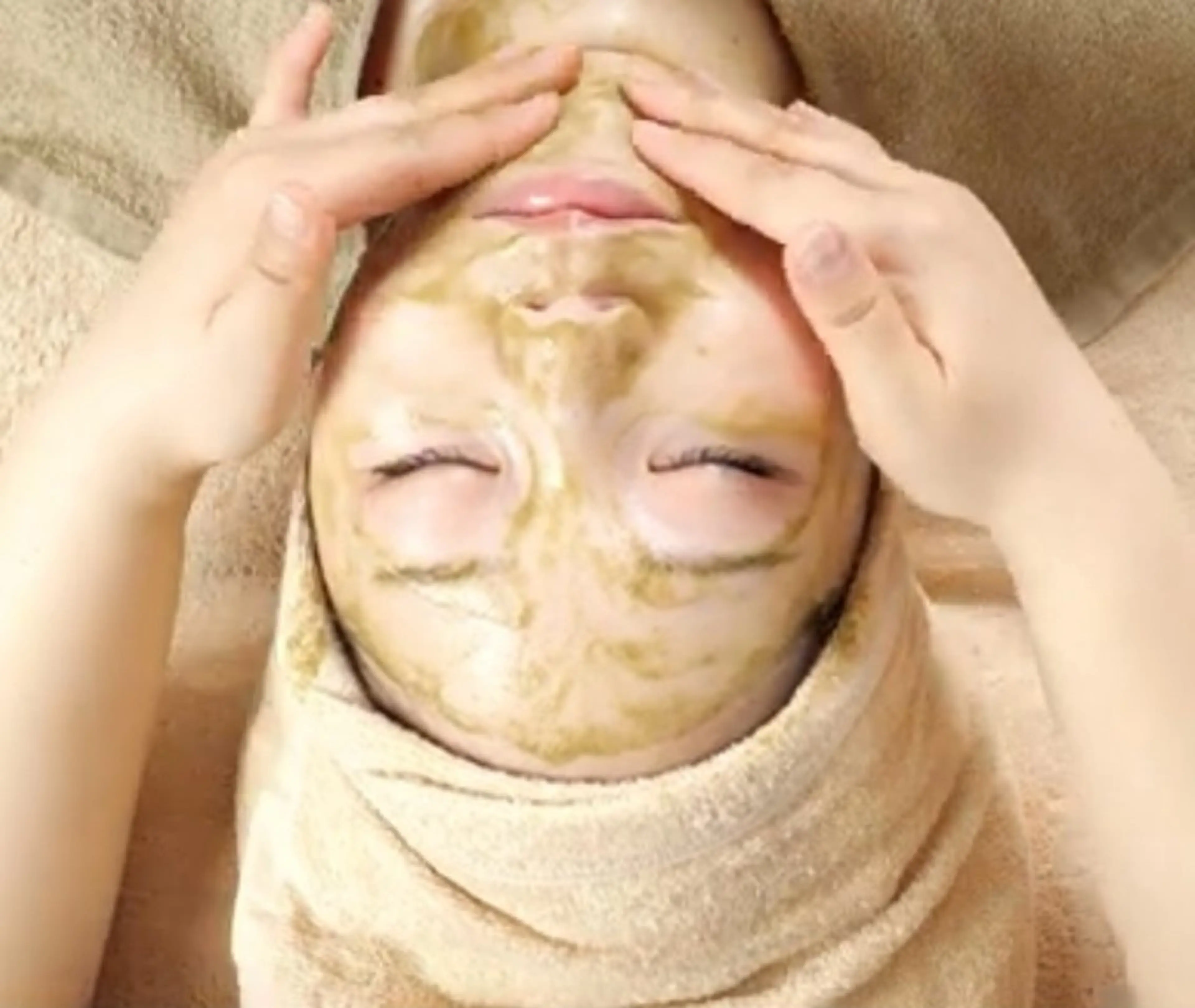 【肌改善】剥離なしハーブピーリング+美肌LED【ニキビ・ニキビ跡・ターンオーバー促進・毛穴・くすみ】の写真