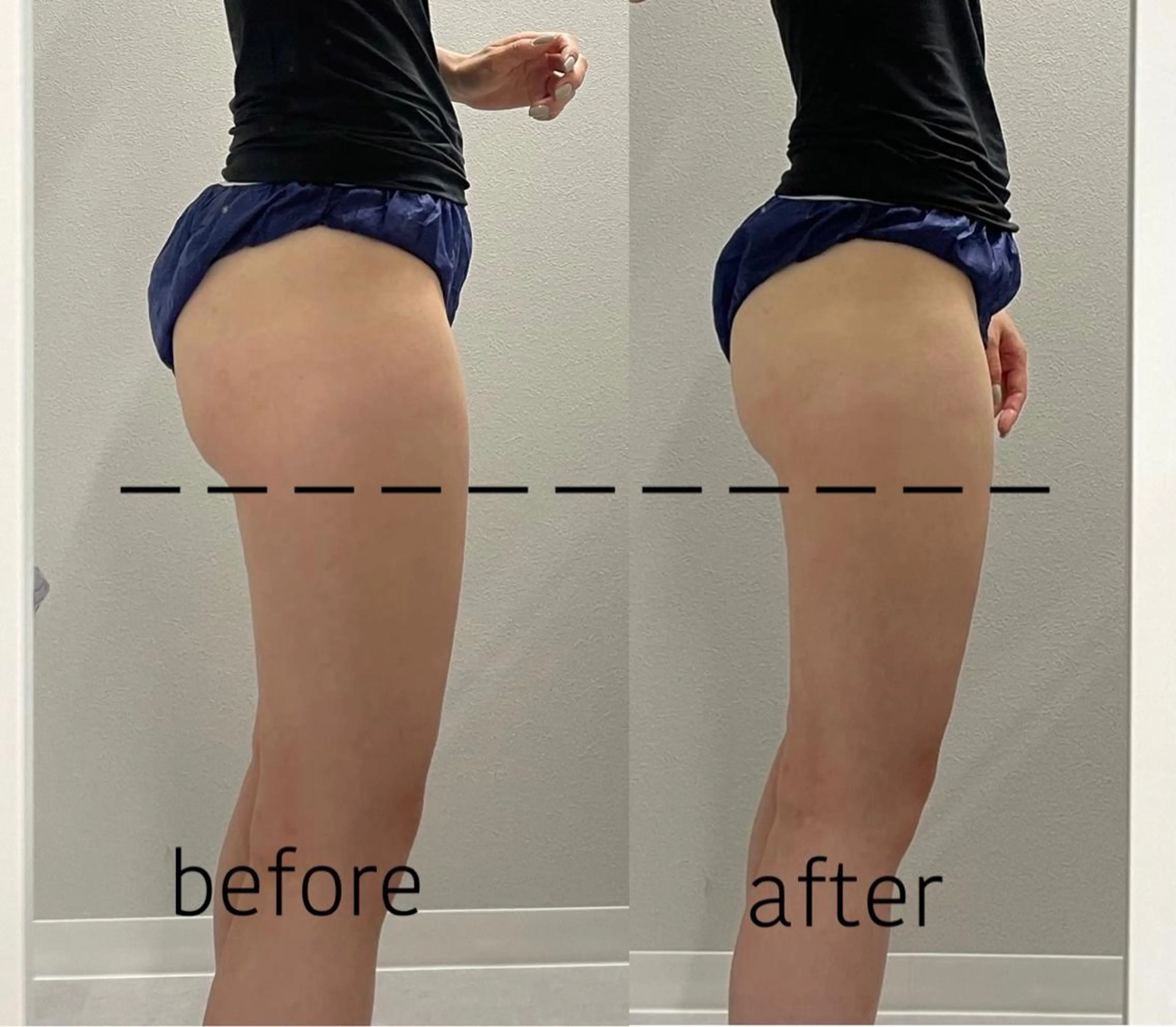 エステ ENCHANT 脱毛.小顔.毛穴のエステ・リラクイメージ