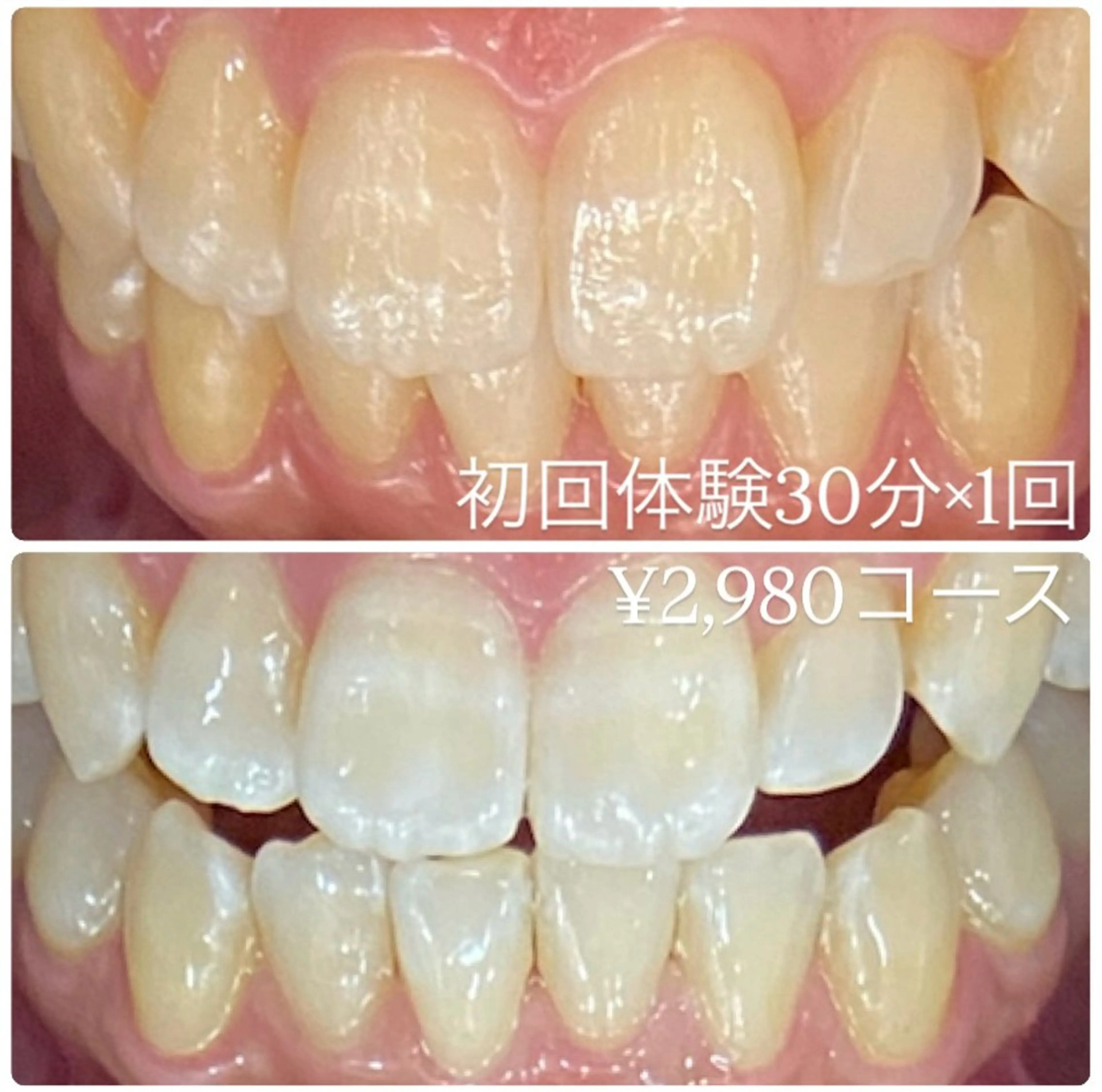 PLATINUM Beauty 横浜店所属・ホワイトニングルーム 横浜店のその他イメージ