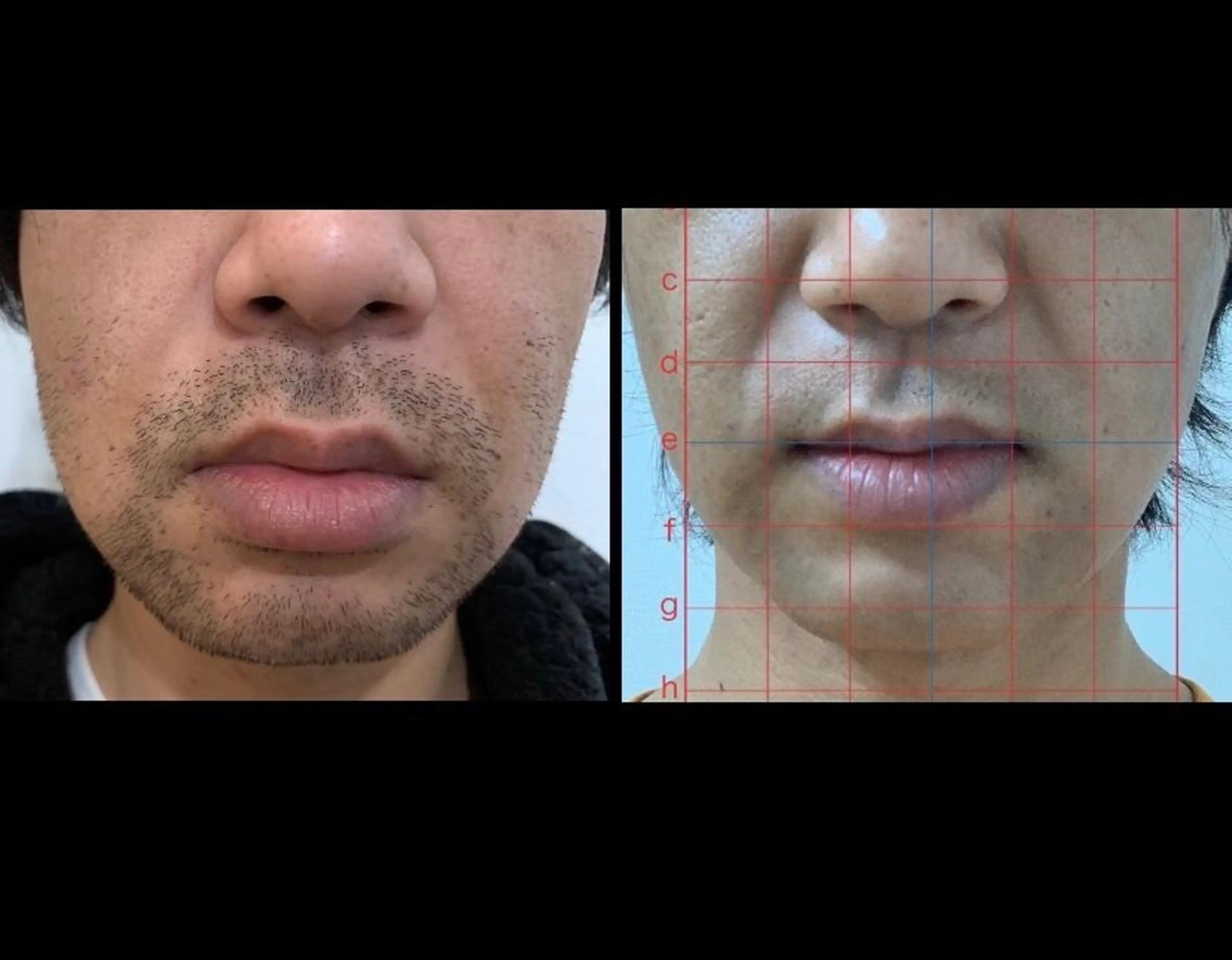 メンズ トータルビューティー サロンCherie2のエステ・リラクイメージ