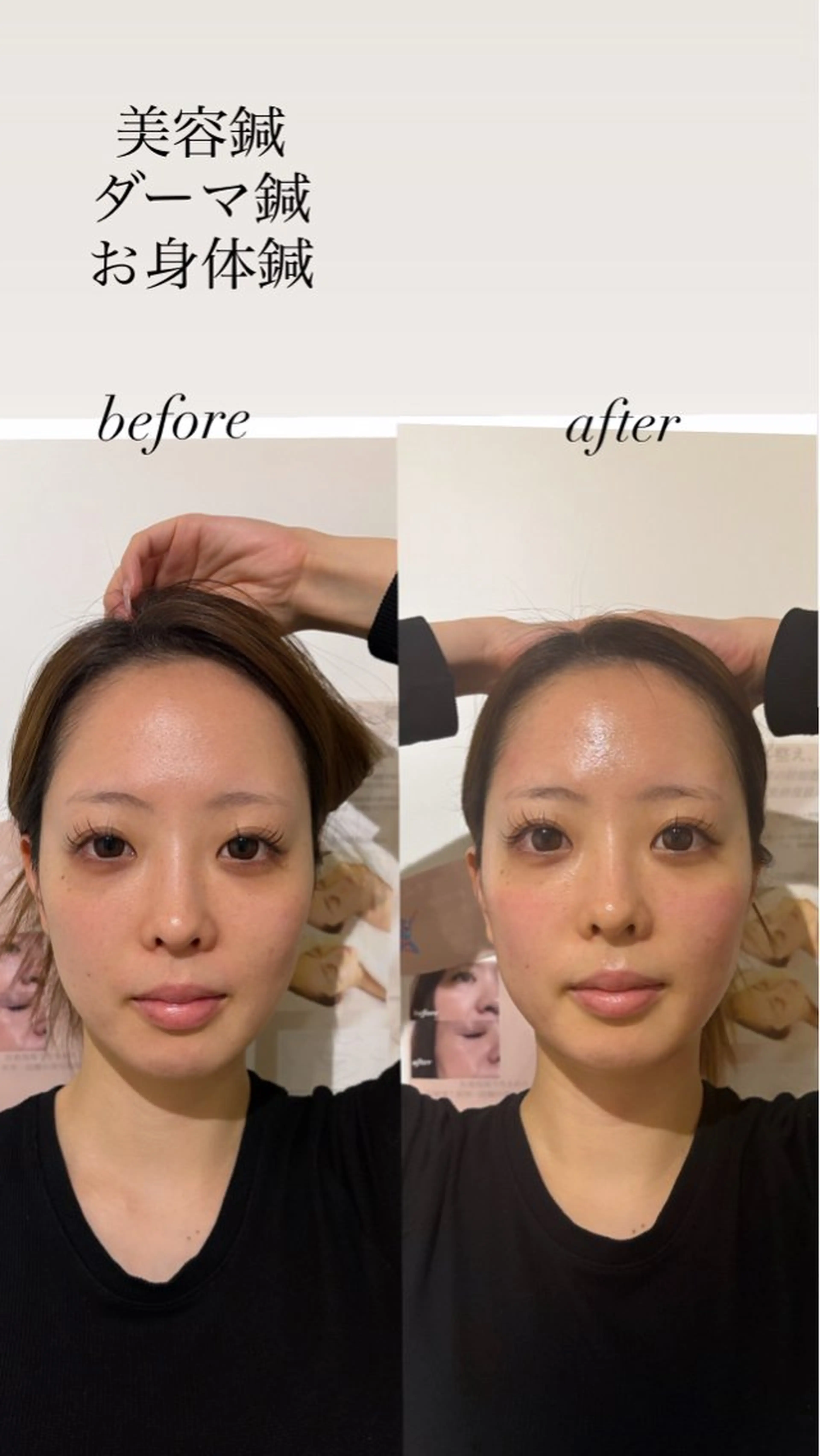 エステ リラク 美容鍼灸サロン mahoroba院長のエステ・リラクイメージ