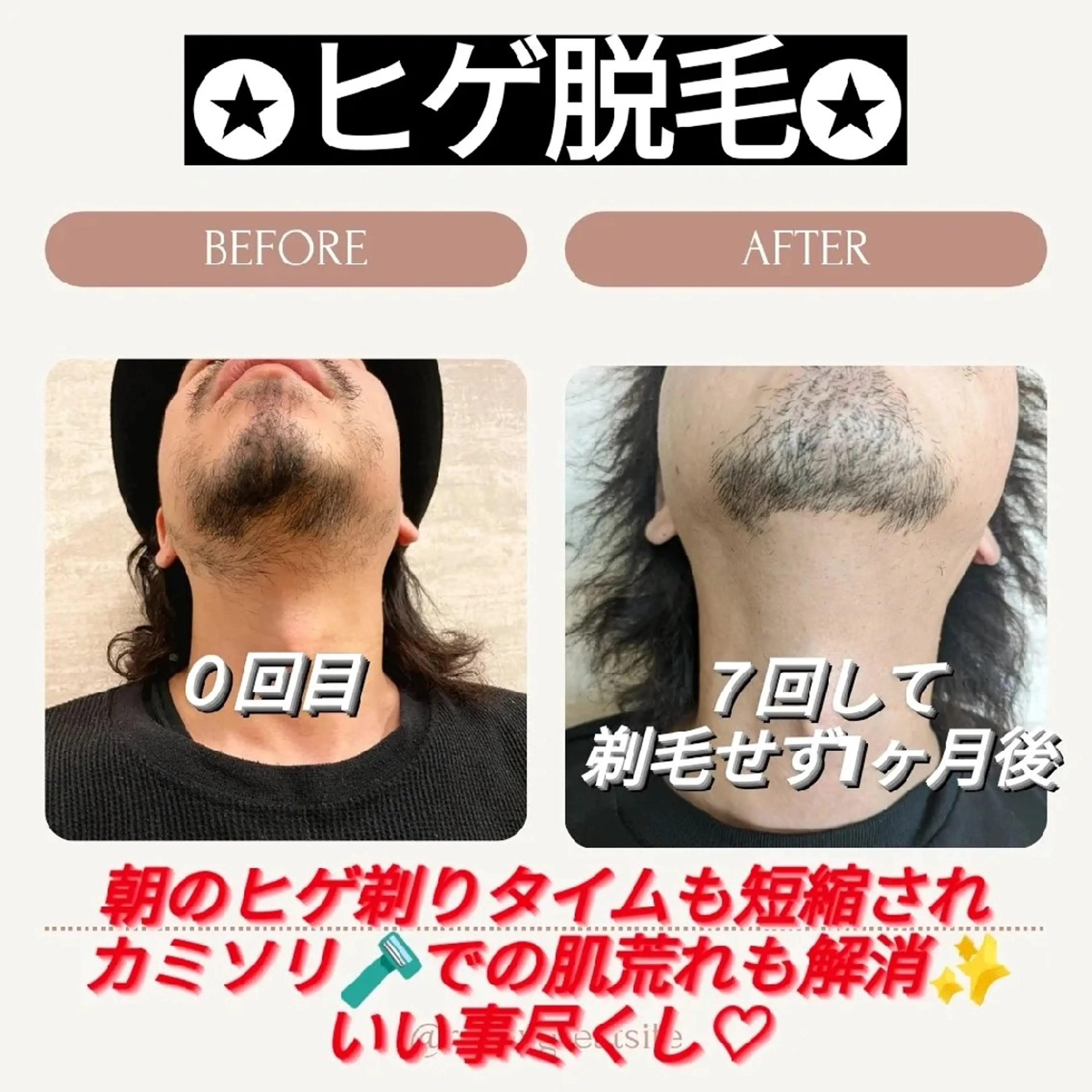 プライベートサロン宿り木所属・江坂@宿り木　脱毛＆ 耳ツボジュエリーのその他イメージ