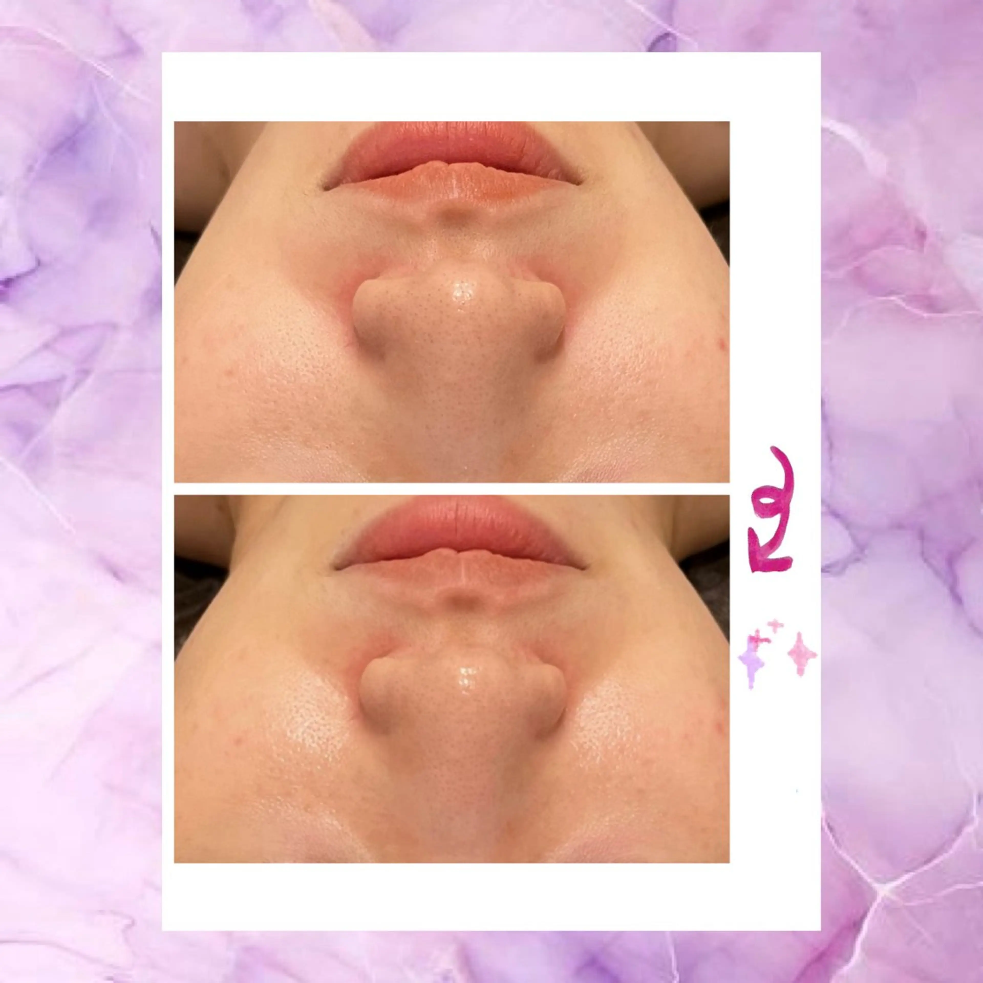 ☆痩身/小顔☆ 結果出します☆のエステ・リラクイメージ