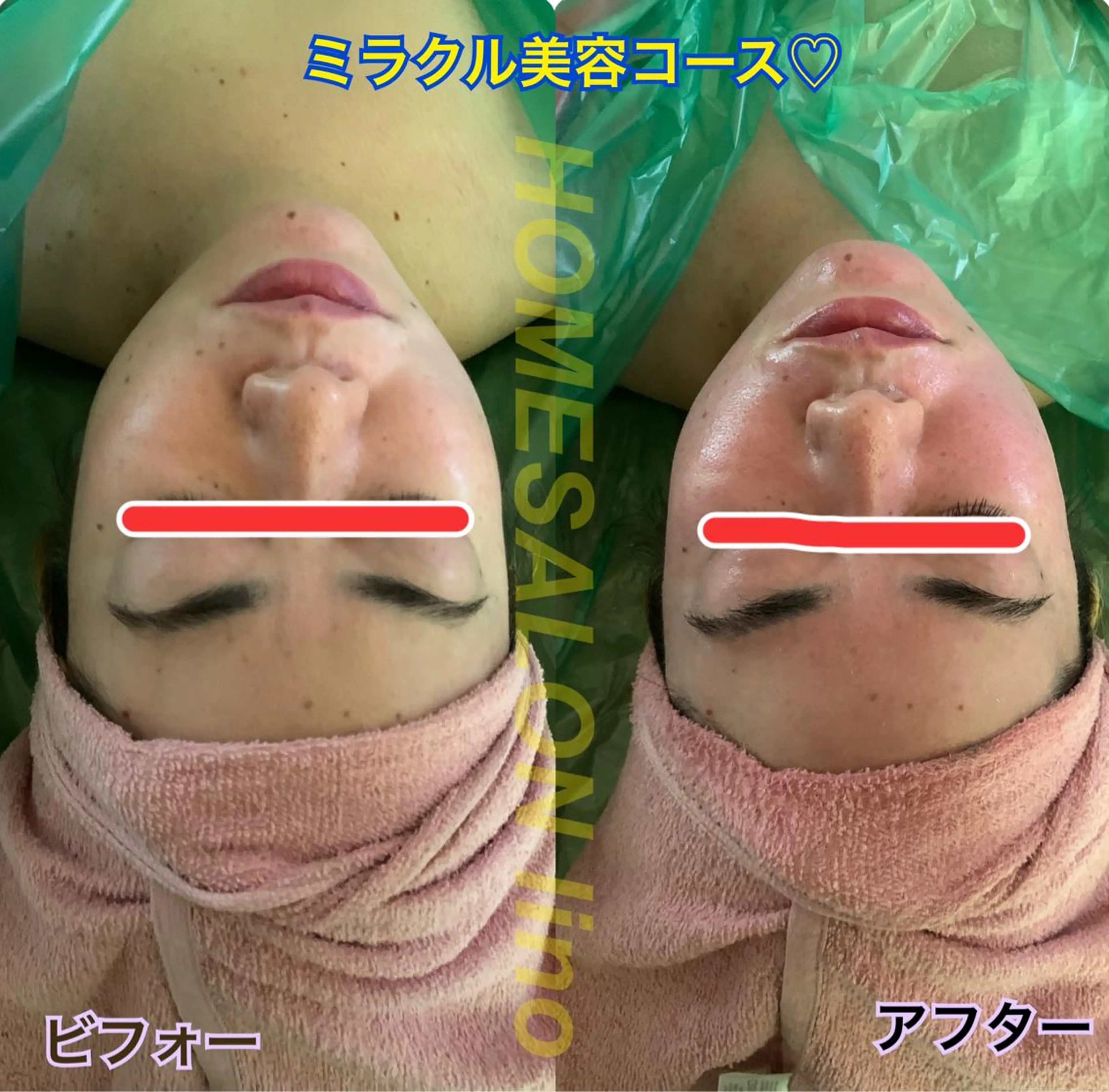 HOME SALON linoのエステ・リラクイメージ