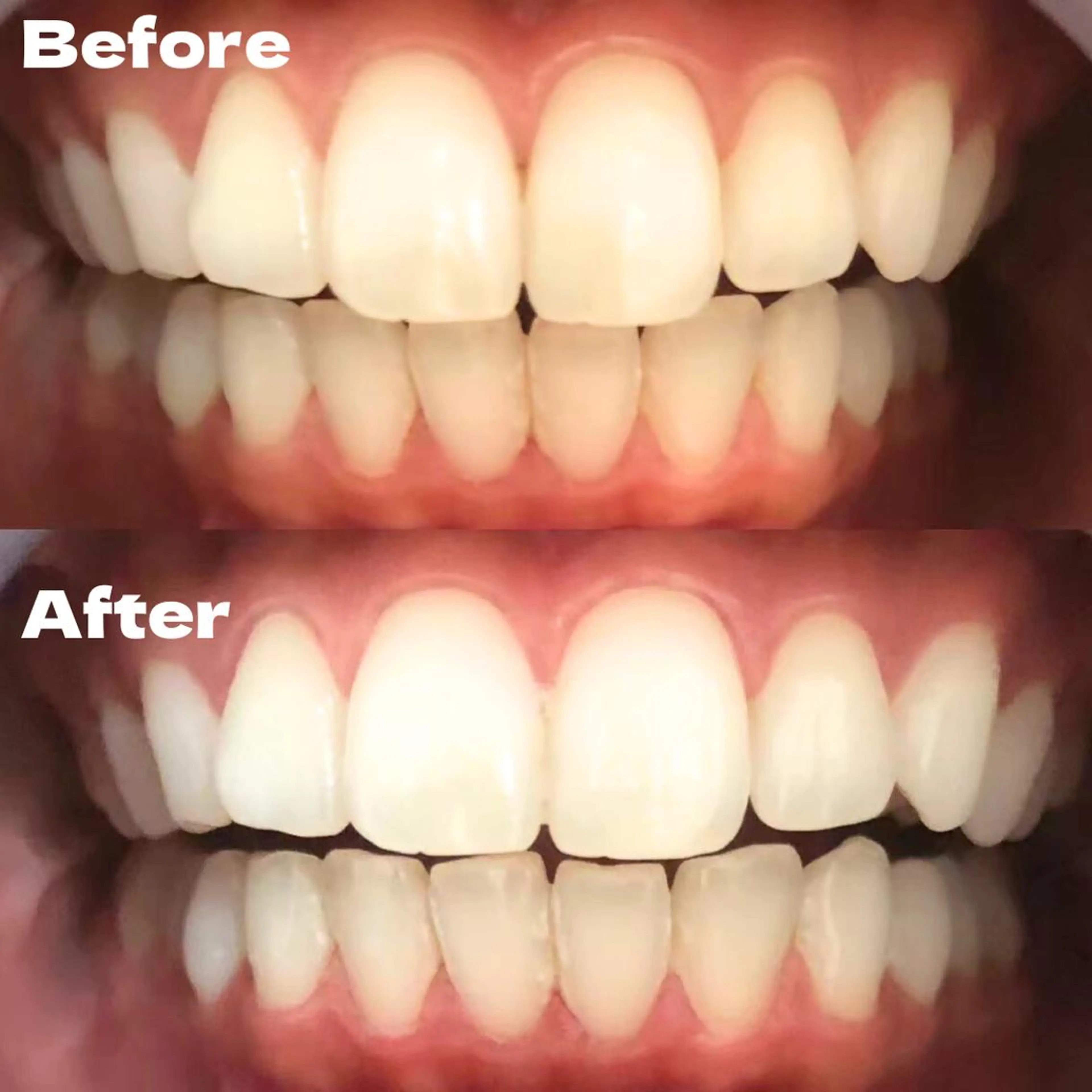 LBSホワイトニング 銀座店💎公式のその他イメージ