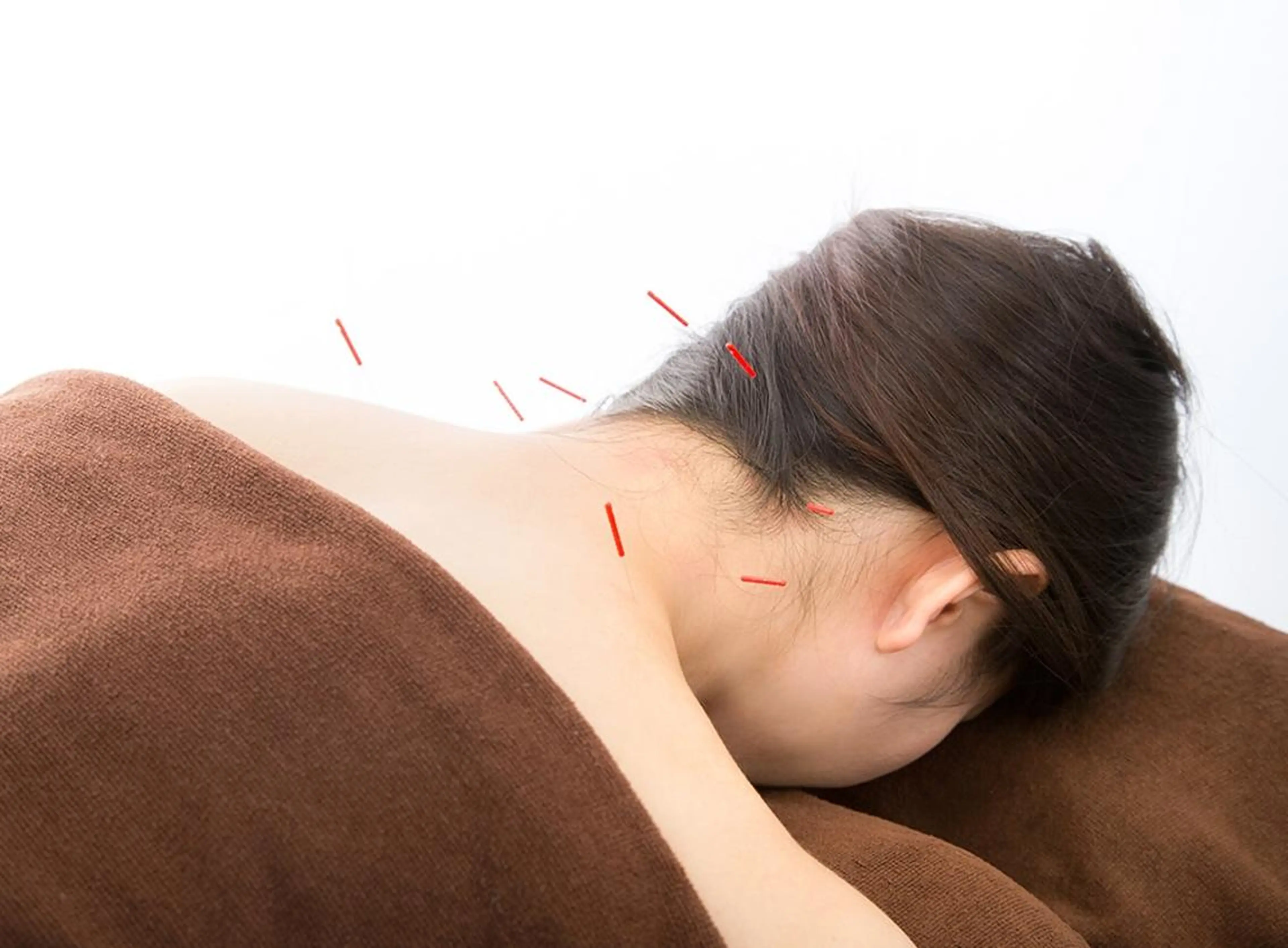 こいわ鍼灸院 HARICOREのエステ・リラクイメージ