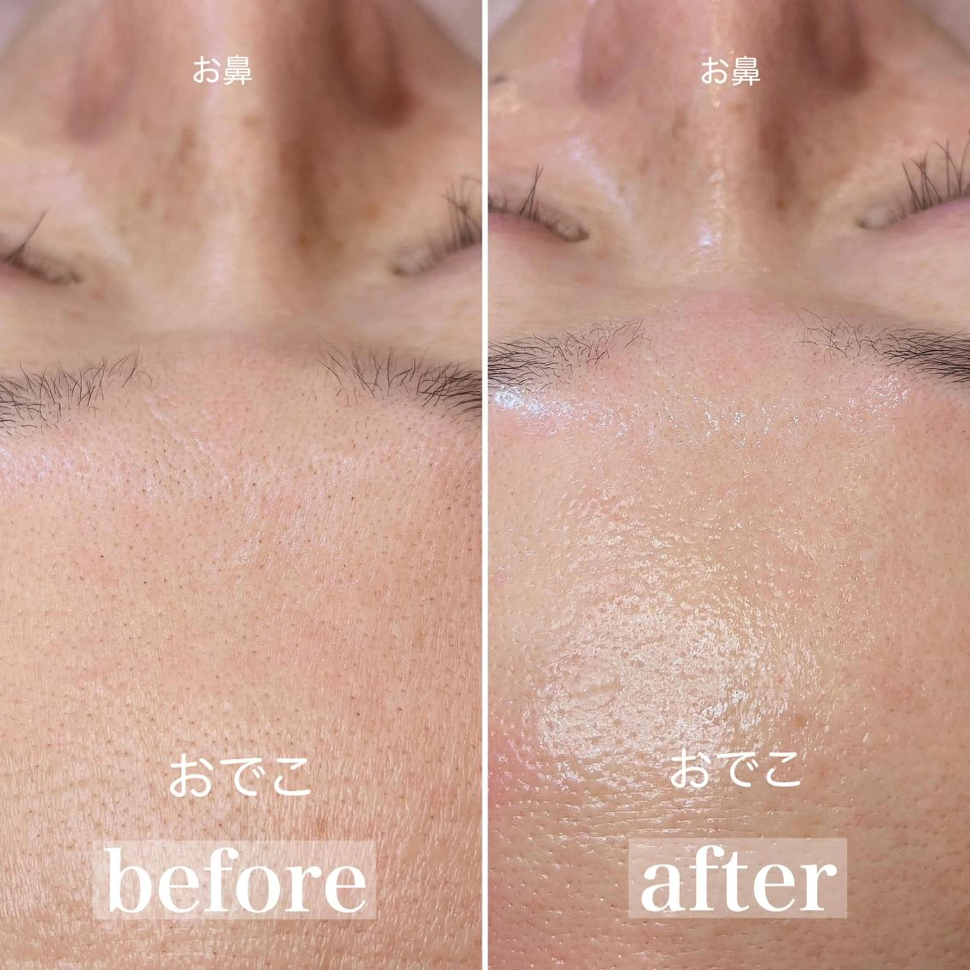 フェイシャルワックス🌿【¥6000】 ※再来7000の写真