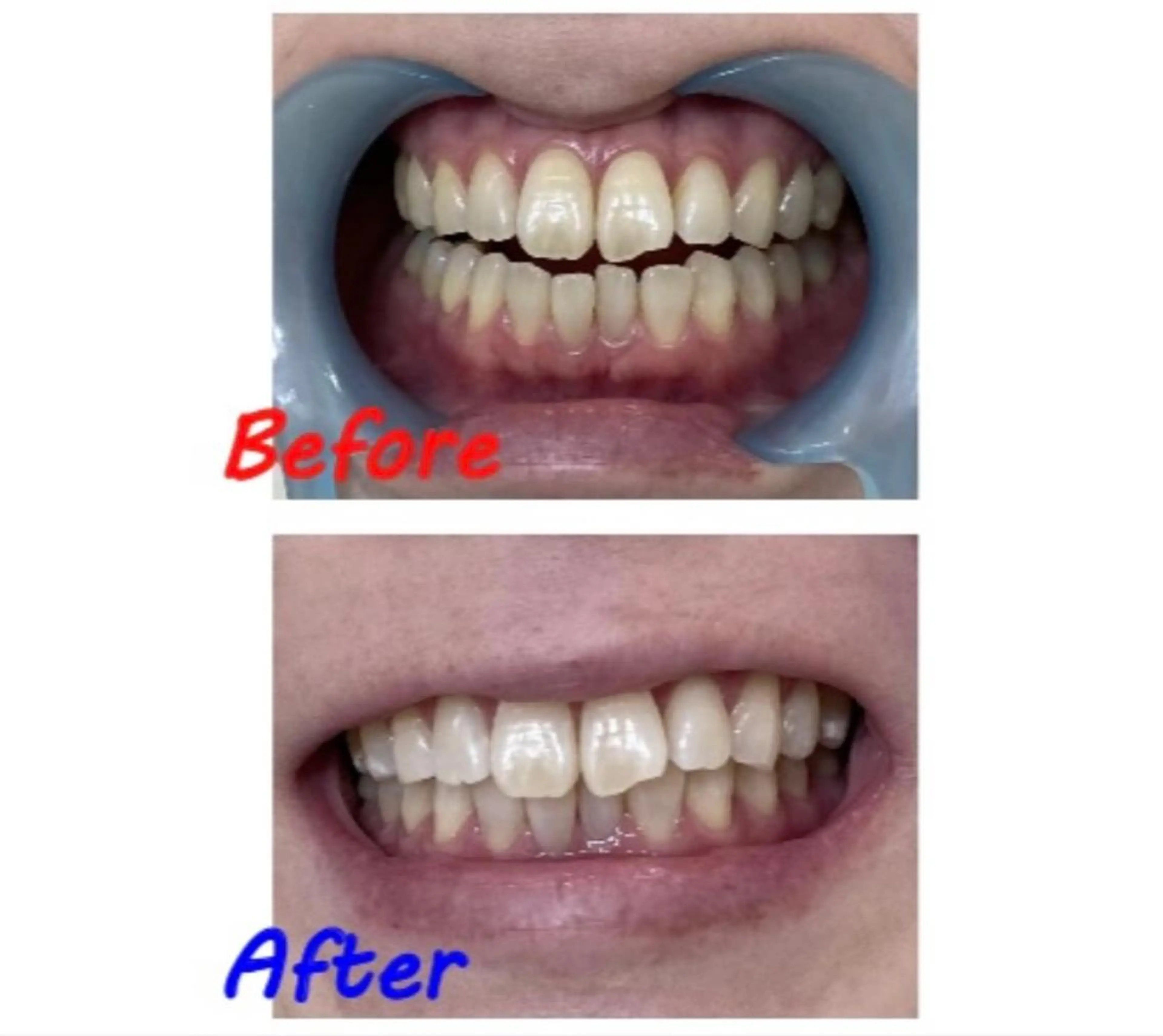 その他 セルフホワイトニングサロン　ラヴィアン所属・ホワイトニングサロン La vie enのその他イメージ