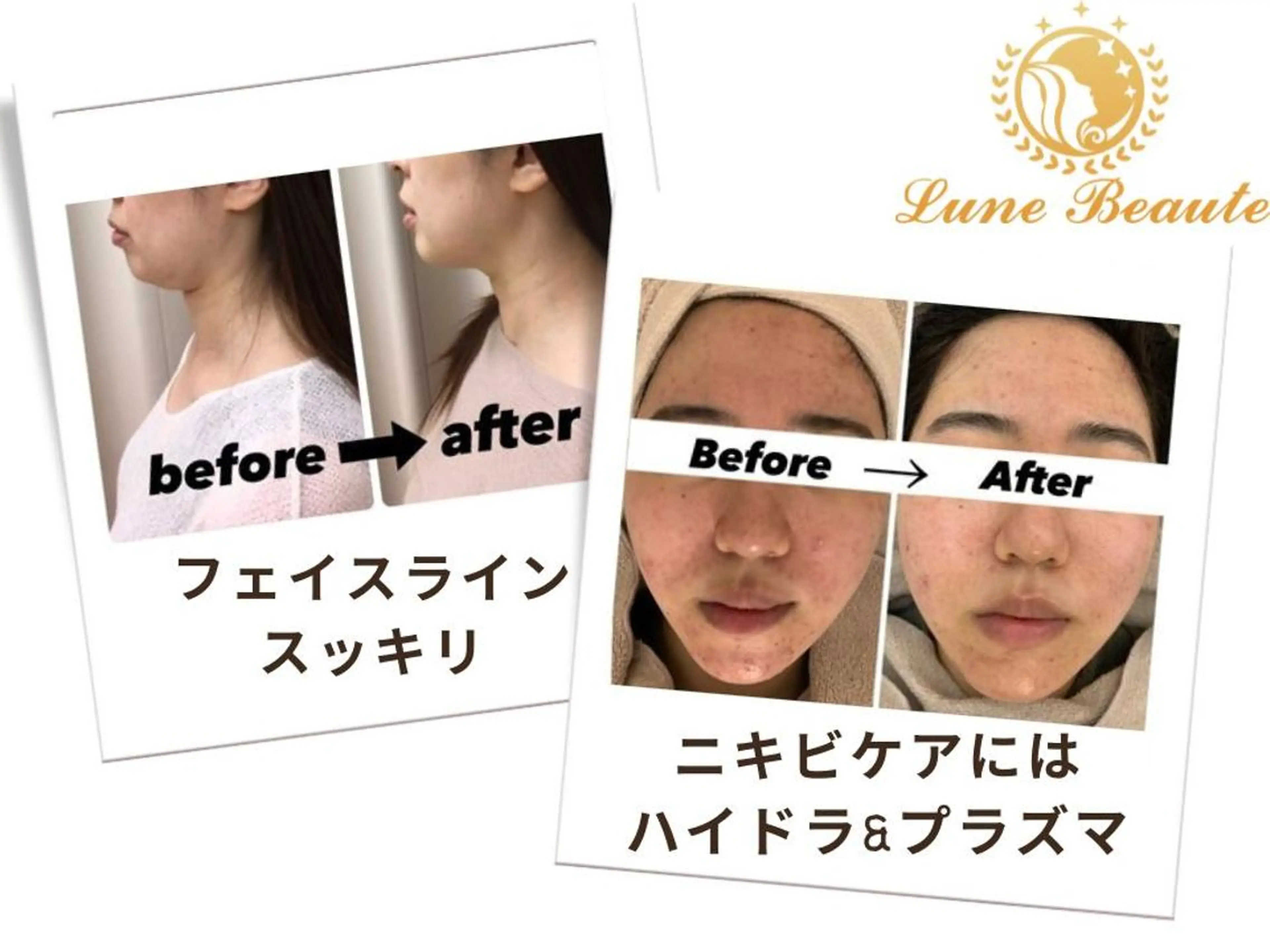 エステ 毛穴&ニキビケア 専門ルナボーテ渋谷のエステ・リラクイメージ