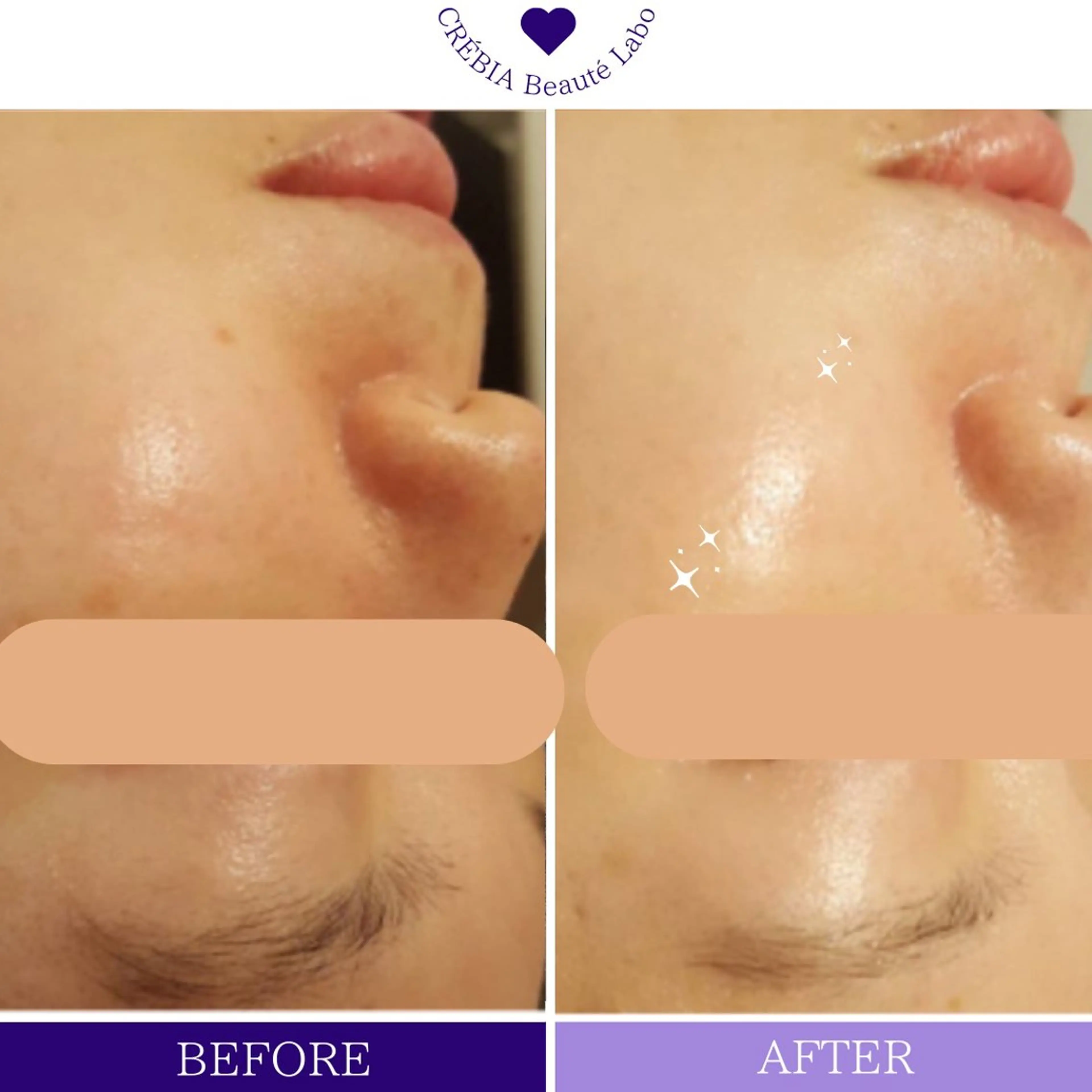 エステ リラク 小顔＆まつ毛サロン AKANE❤️のエステ・リラクイメージ