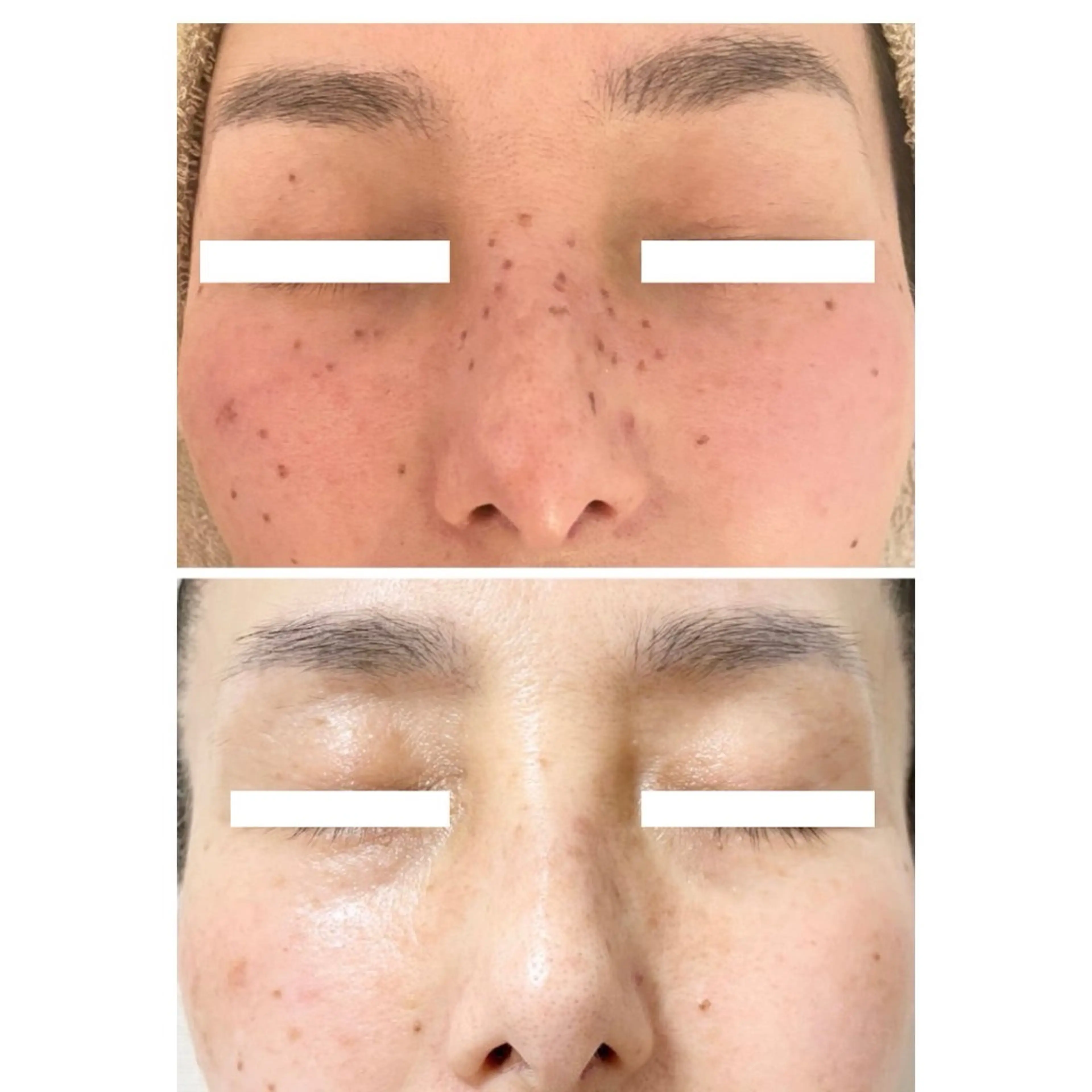 エステ 毛穴シミ改善専門 サロンド・ルパークのエステ・リラクイメージ