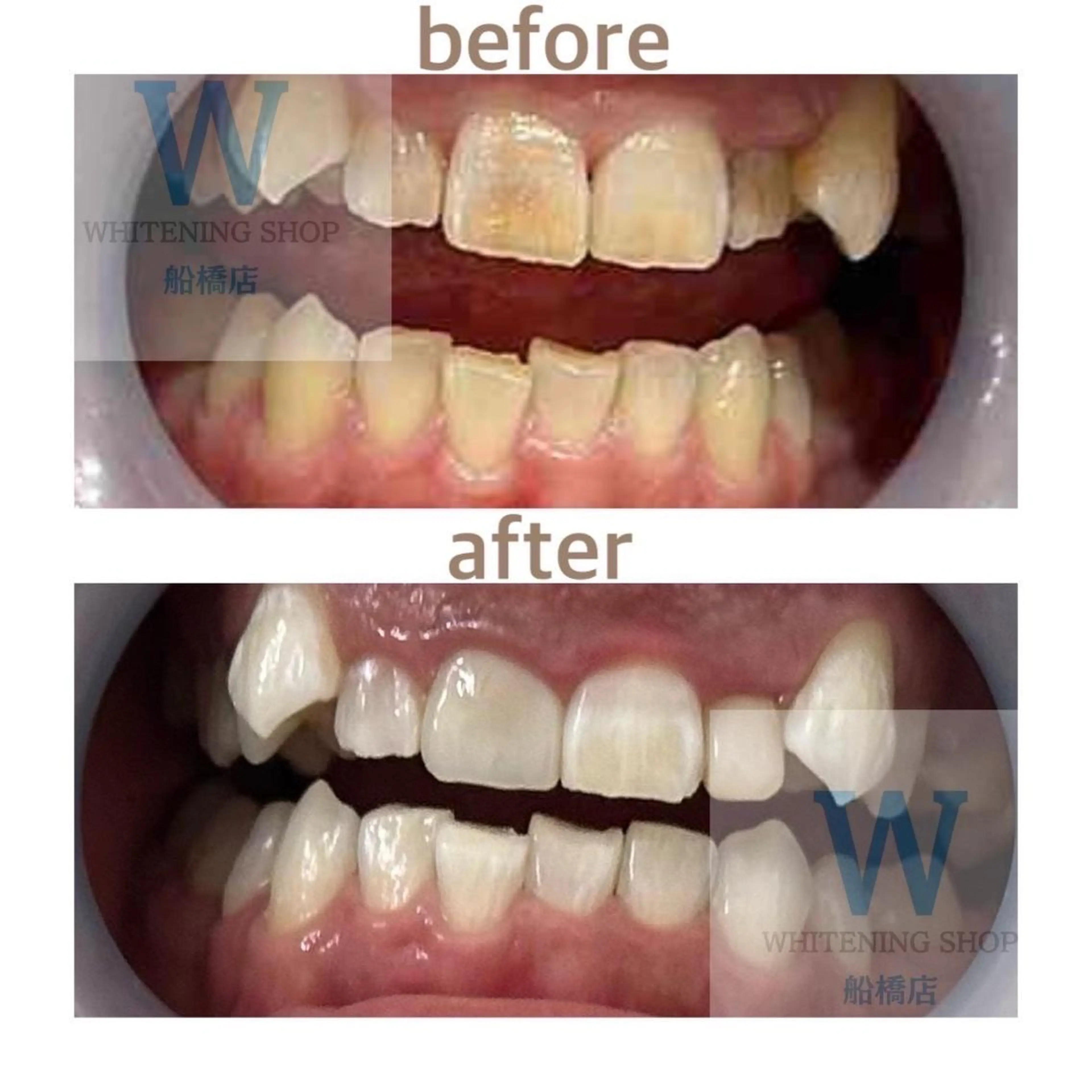 エステ リラク ホワイトニング ショップ船橋店🦷のエステ・リラクイメージ