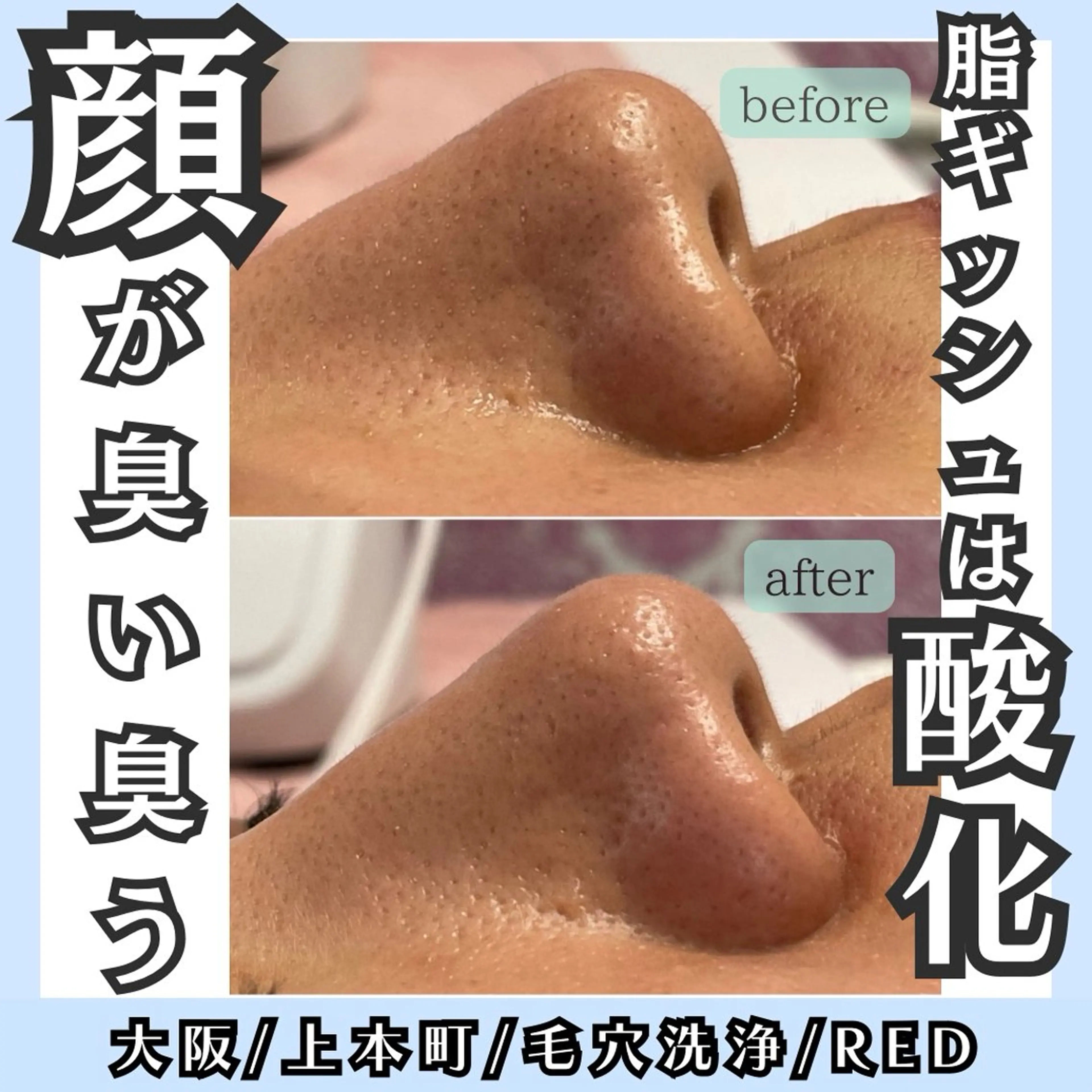 毛穴レス ハーブ＆ ワックス脱毛×光脱毛のエステ・リラクイメージ