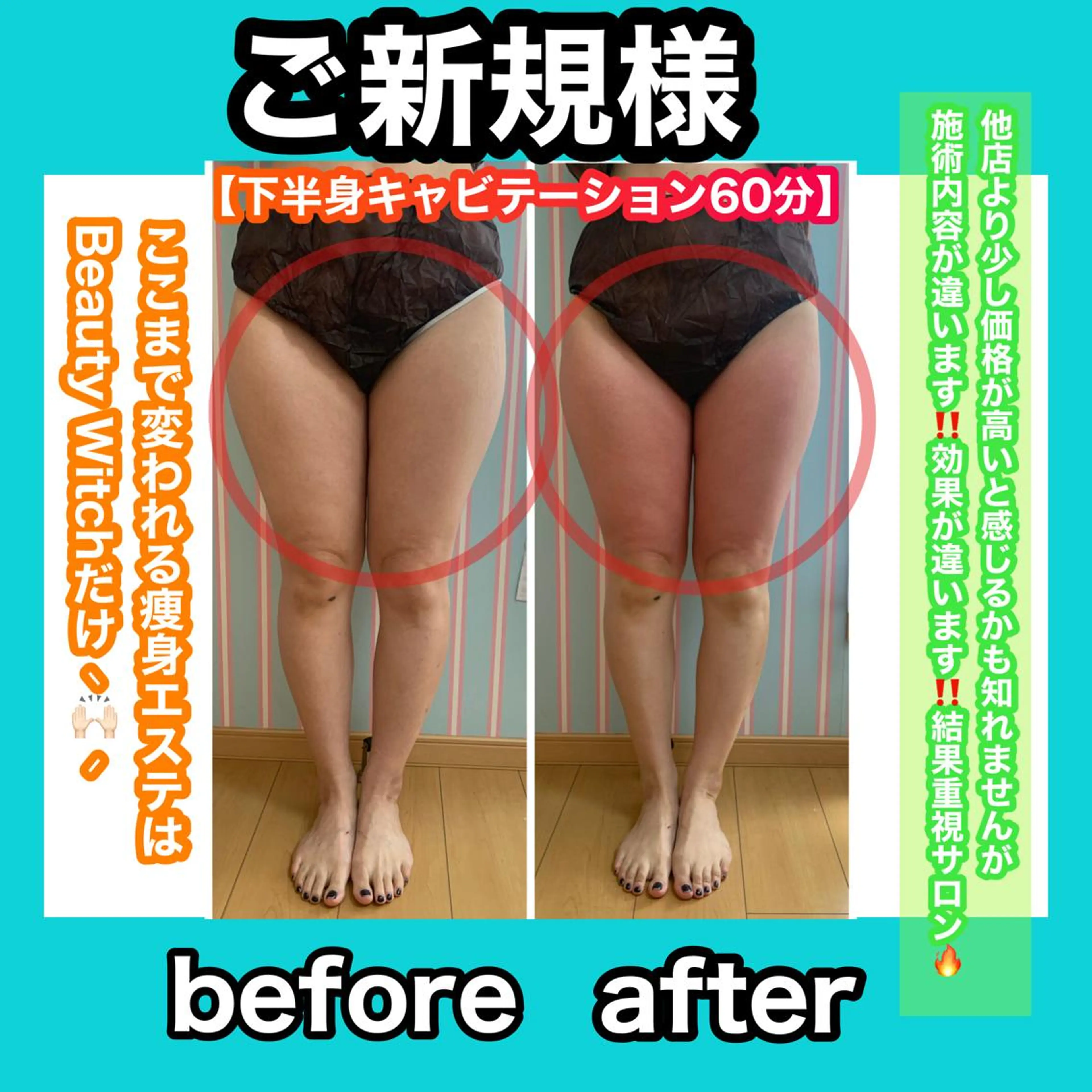 エステ リラク 痩身/脱毛/ネイル HARUKAのエステ・リラクイメージ