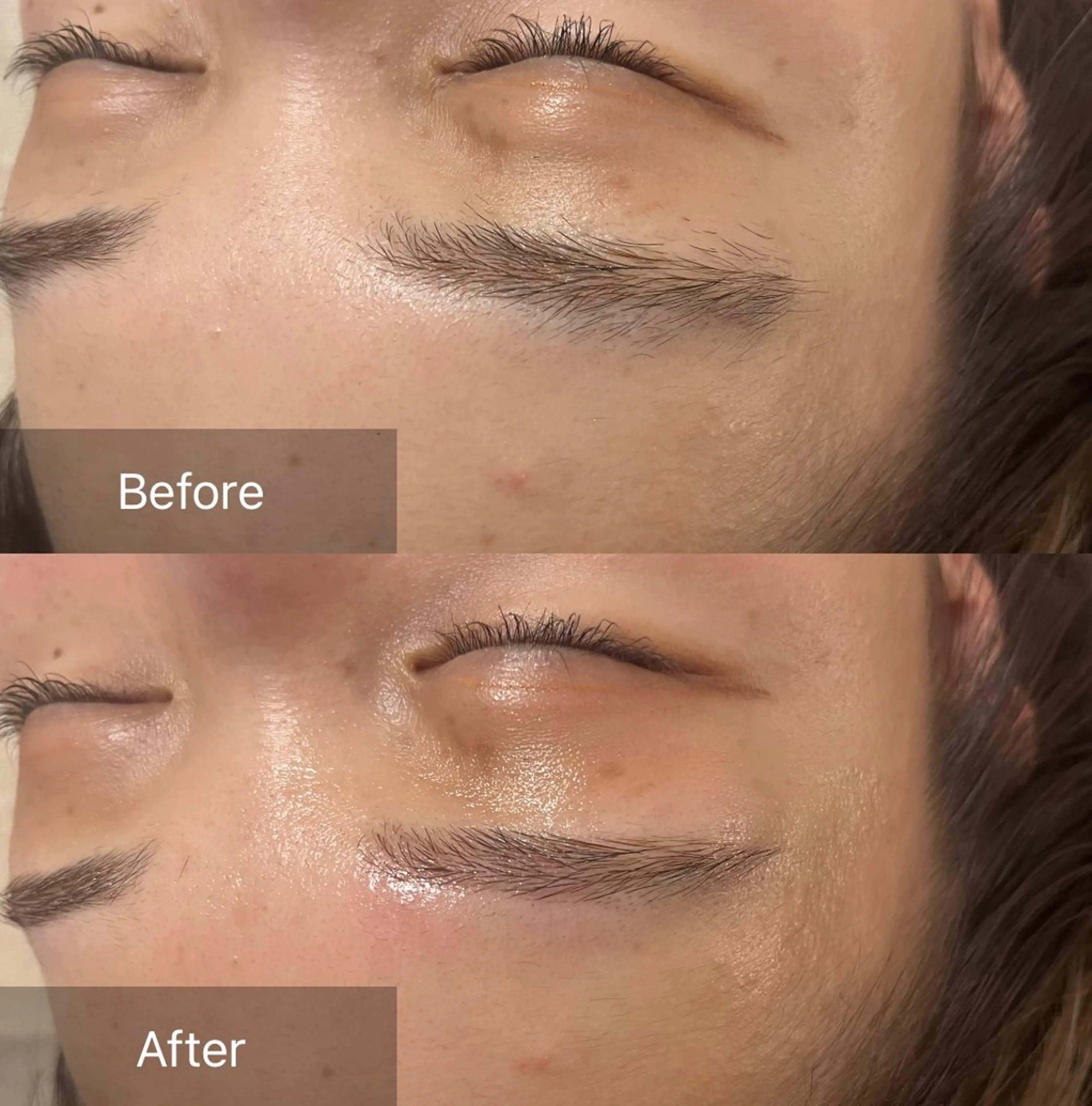 アイブロウ ワックス脱毛 眉カット その他(アイブロウ) for woman所属・森 美優のエステ・リラクイメージ