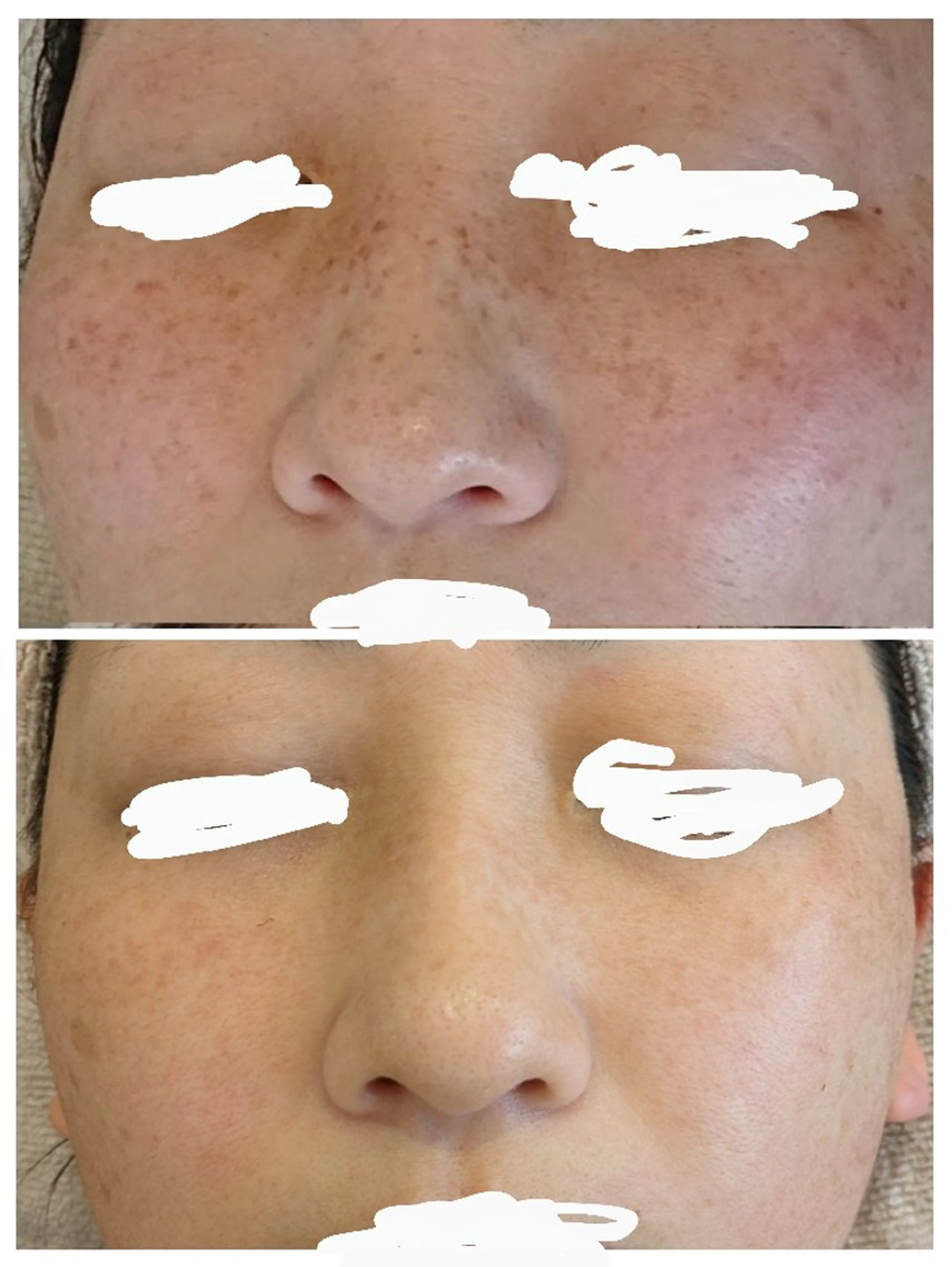 babyaiai所属・babyaiai 　momo🍑のエステ・リラクイメージ