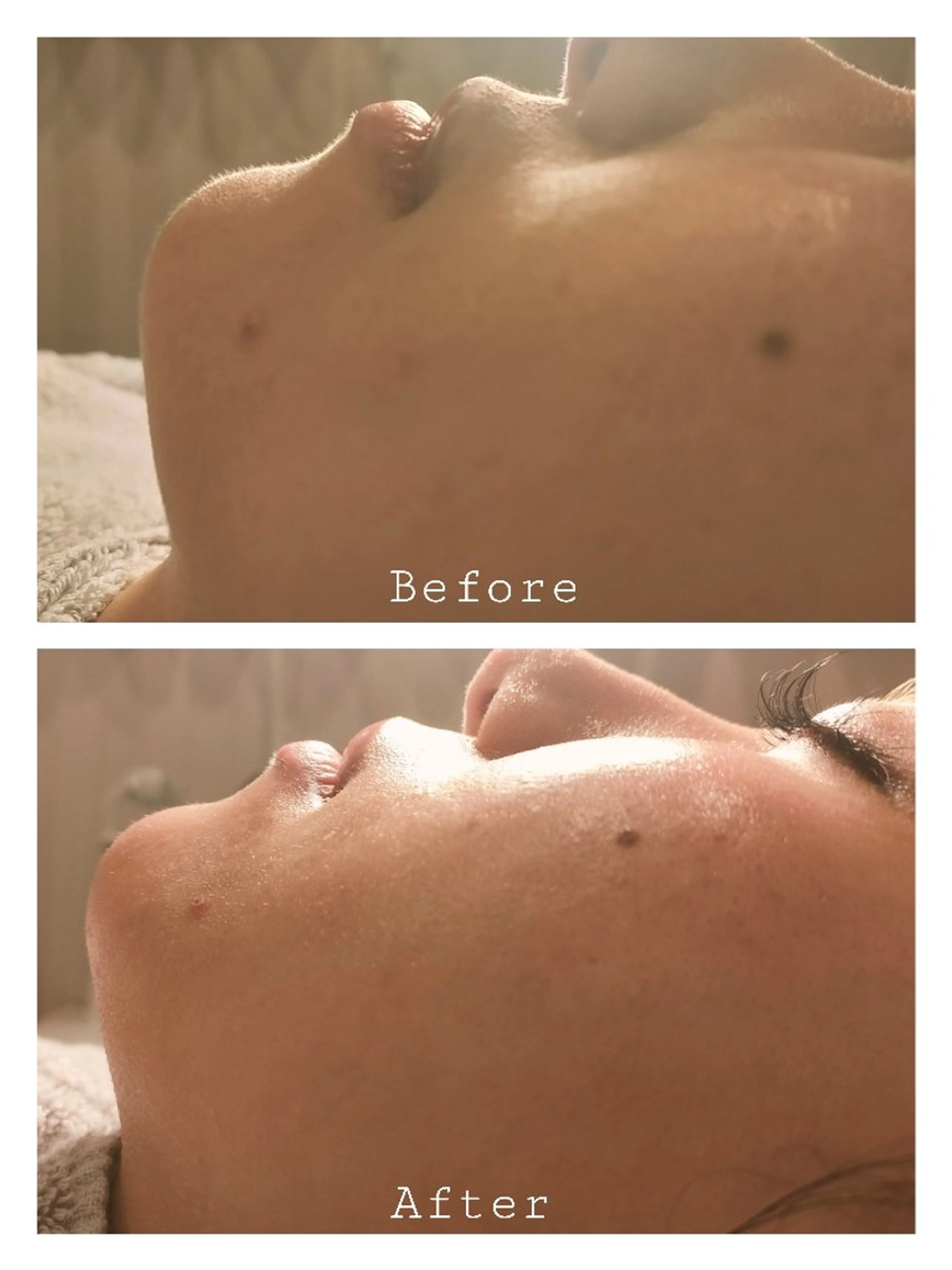 フェイスWax＆HYDROJELLYMASK 🩵の写真