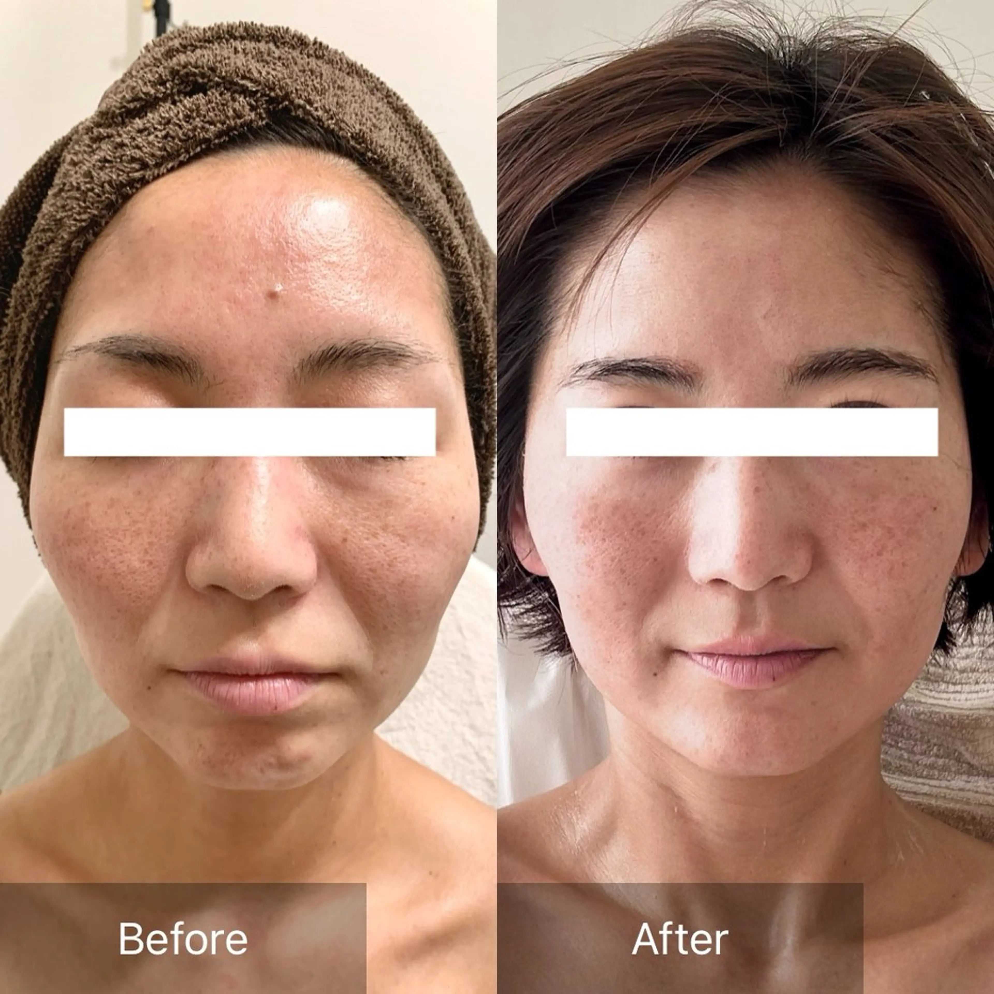 Charis エステ&ネイルのエステ・リラクイメージ