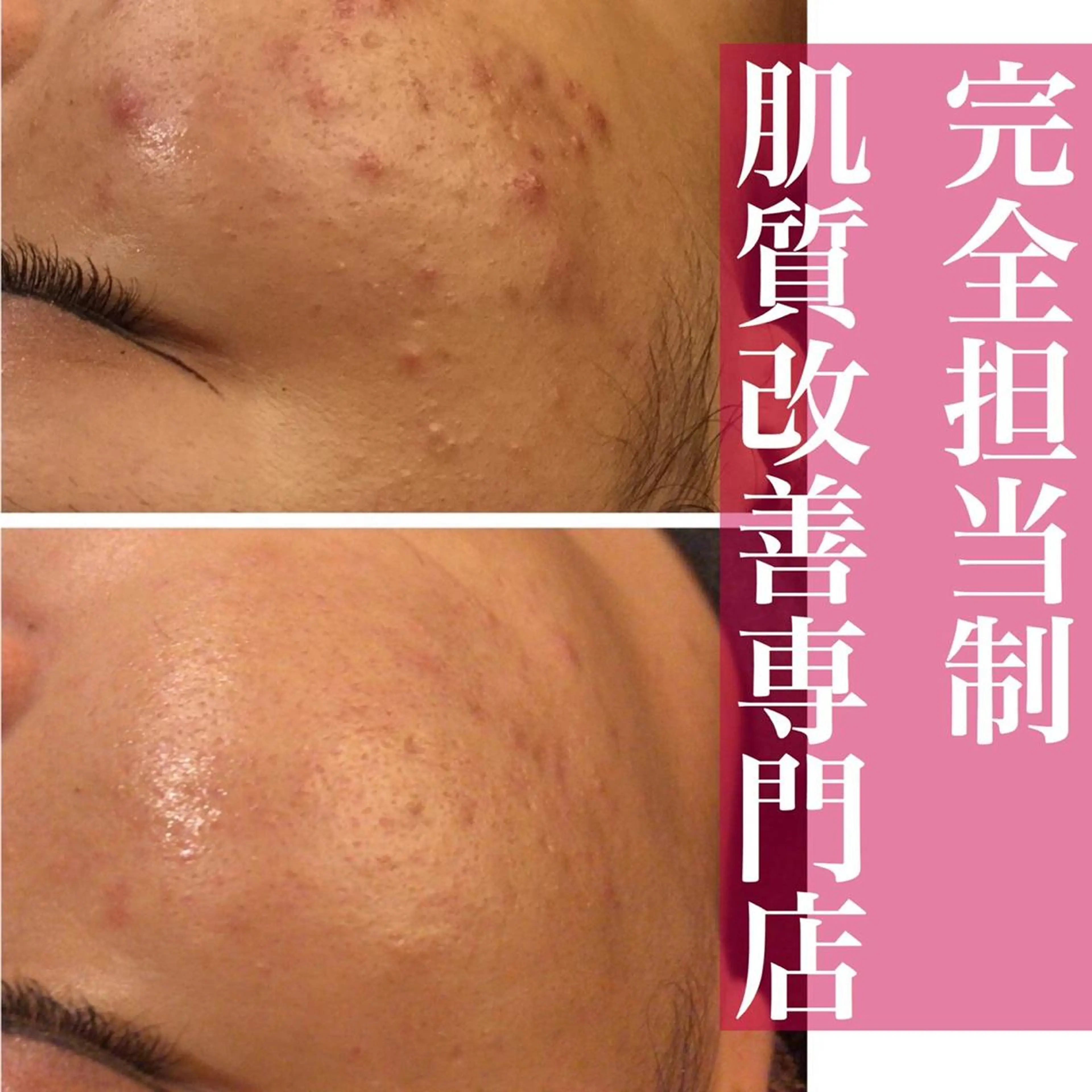 ミディアム カラー パーマ ヘアアレンジ メンズ キッズ ネイル マツエク・マツパ アイブロウ エステ リラク ニキビ・肌質改善専門 ♡人生が変わるサロンのエステ・リラクイメージ