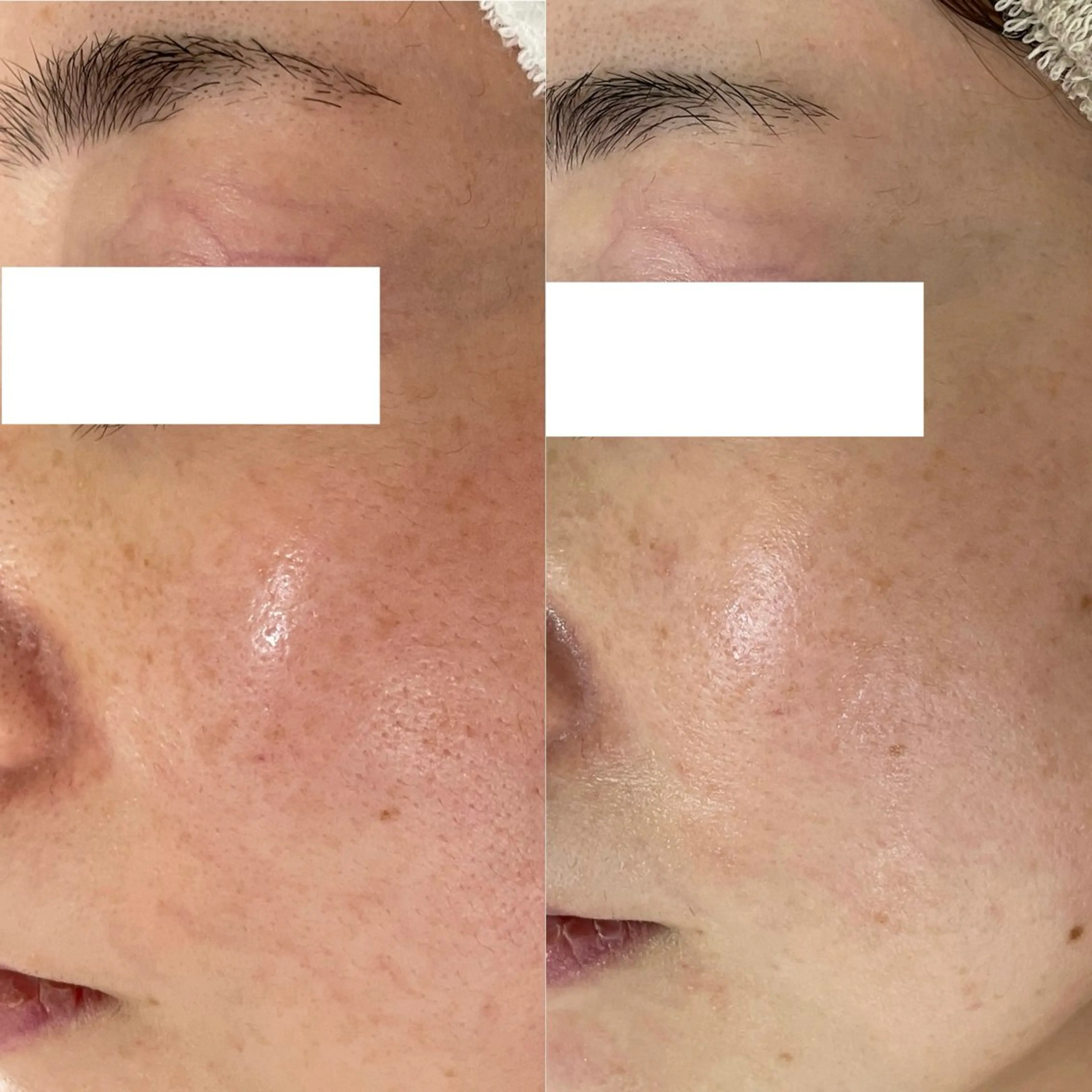 シェノン所属・ニキビ・毛穴・ フェイシャル専門店のその他イメージ