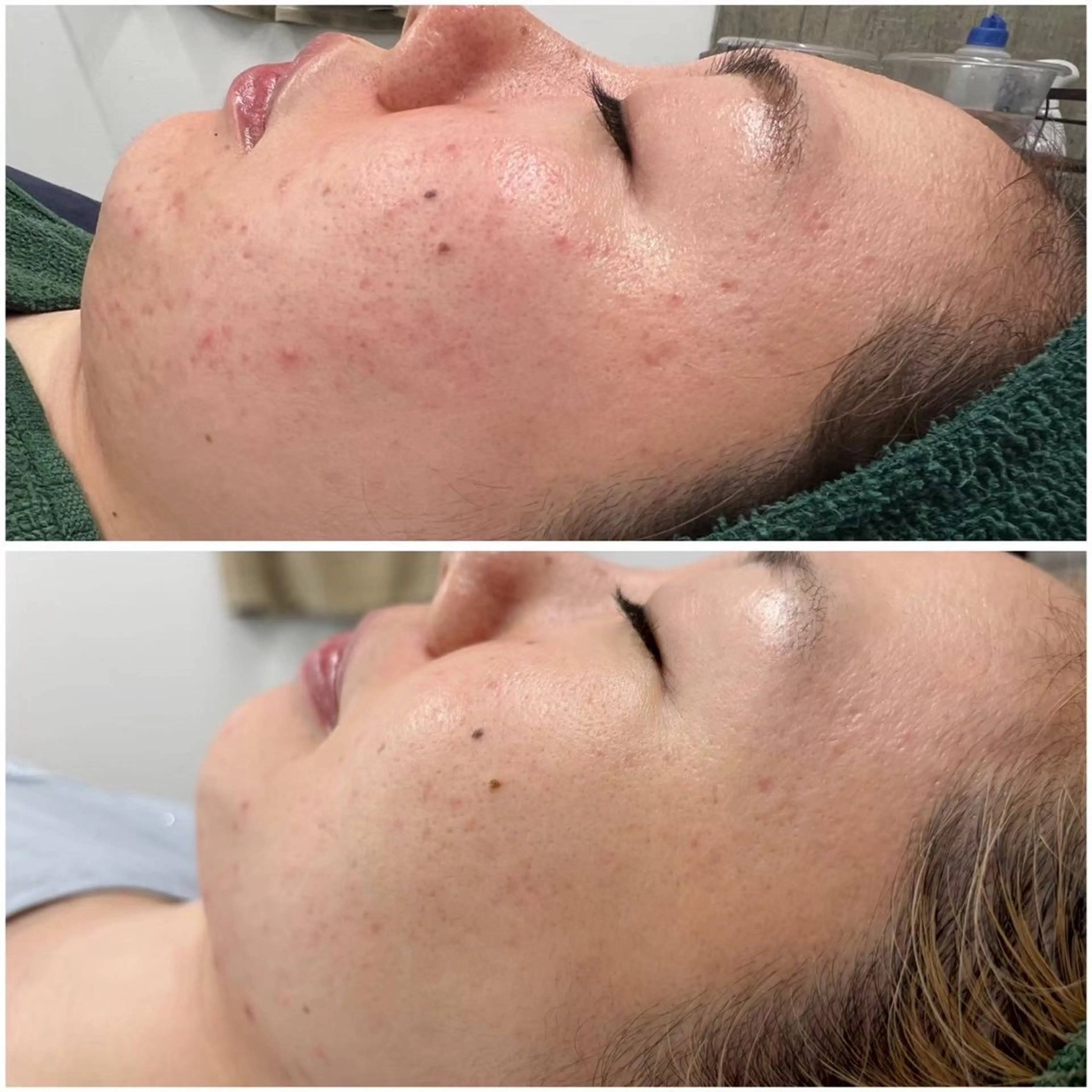 BLANC.【新宿店】所属・ハーブピーリング ayamiのエステ・リラクイメージ