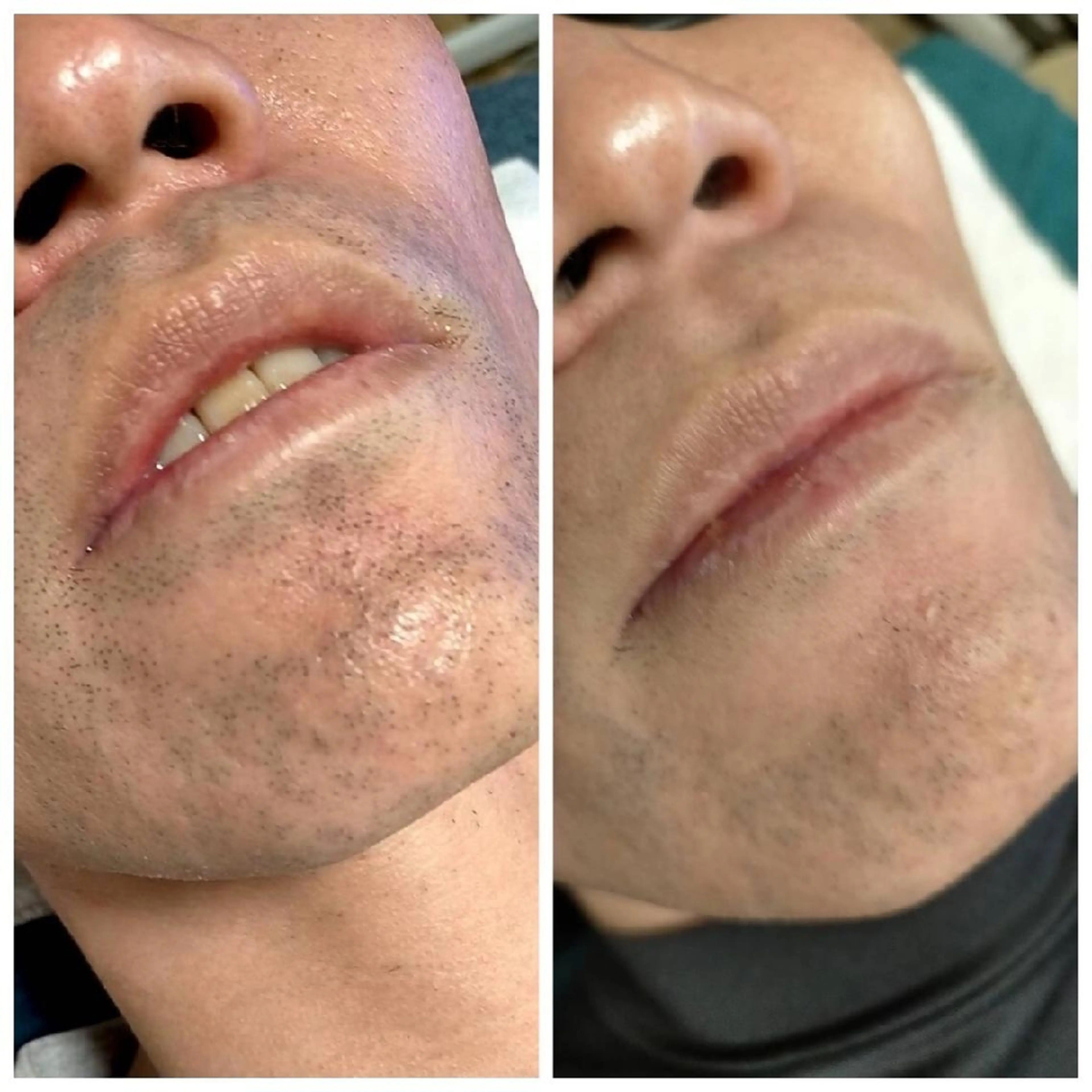 メンズ muscle＆esthe jonny's beauty所属・jonny's beautyのエステ・リラクイメージ