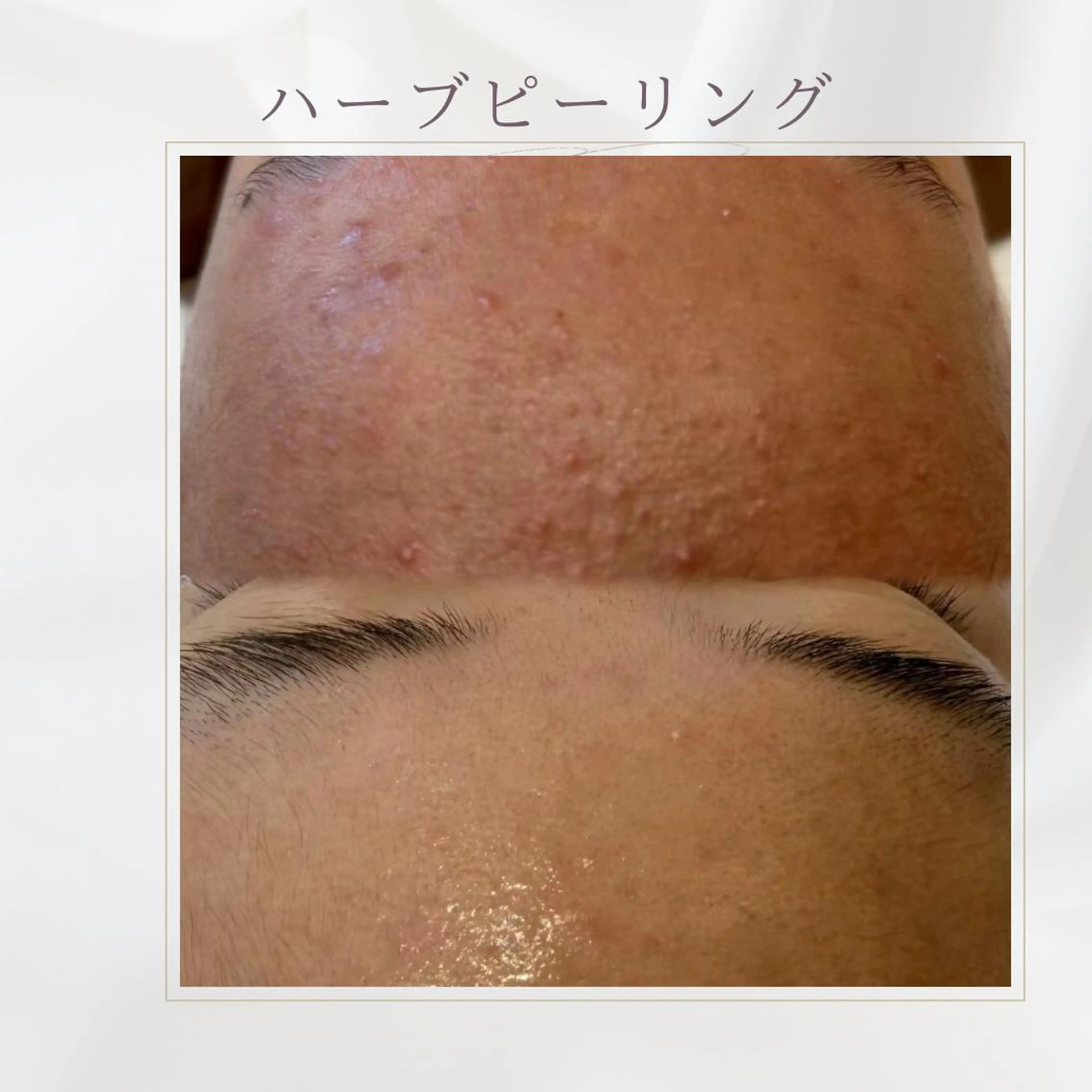 西区九条エステ MITUREIサロンのエステ・リラクイメージ