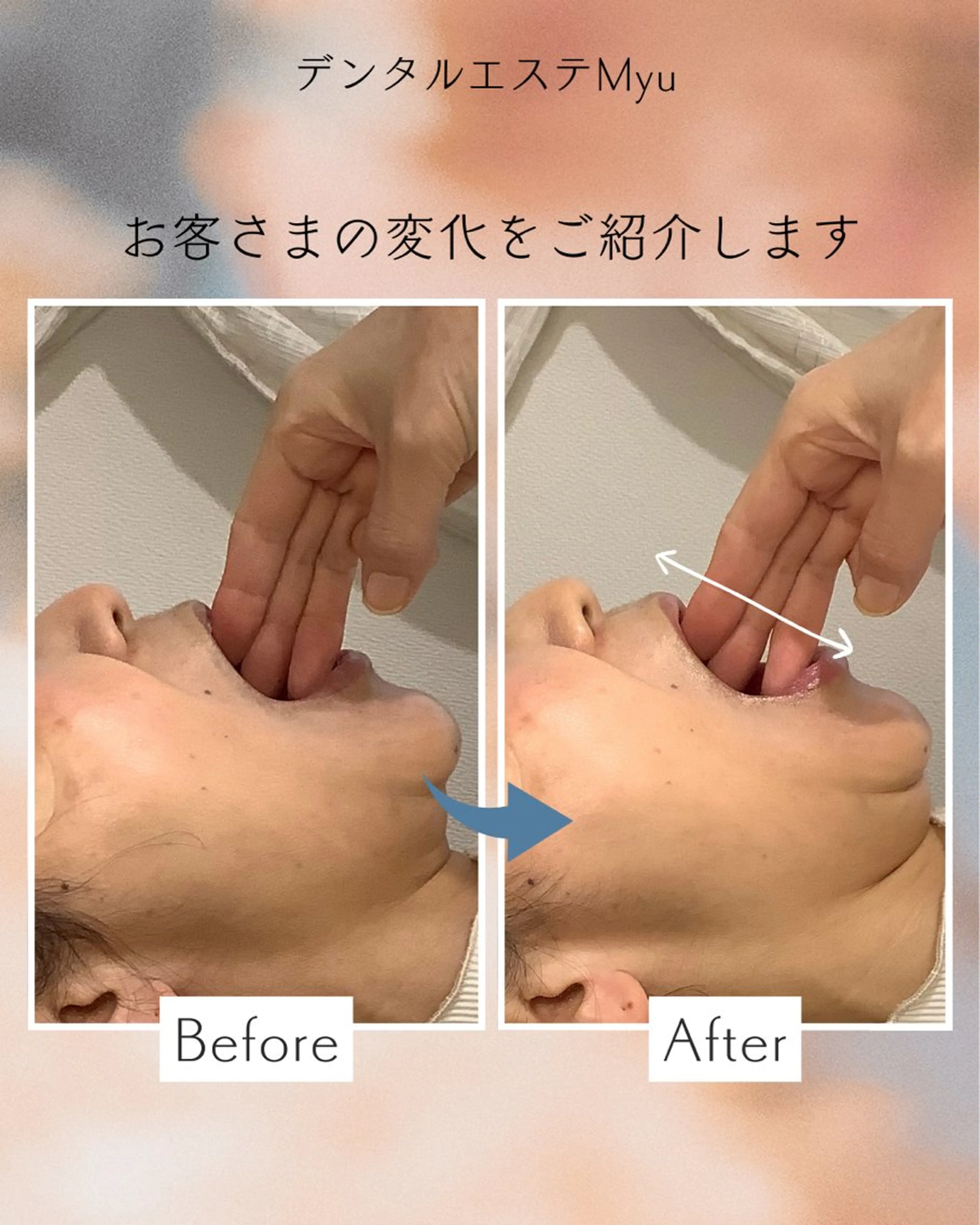 Myu所属・Suzuki Yumiのエステ・リラクイメージ