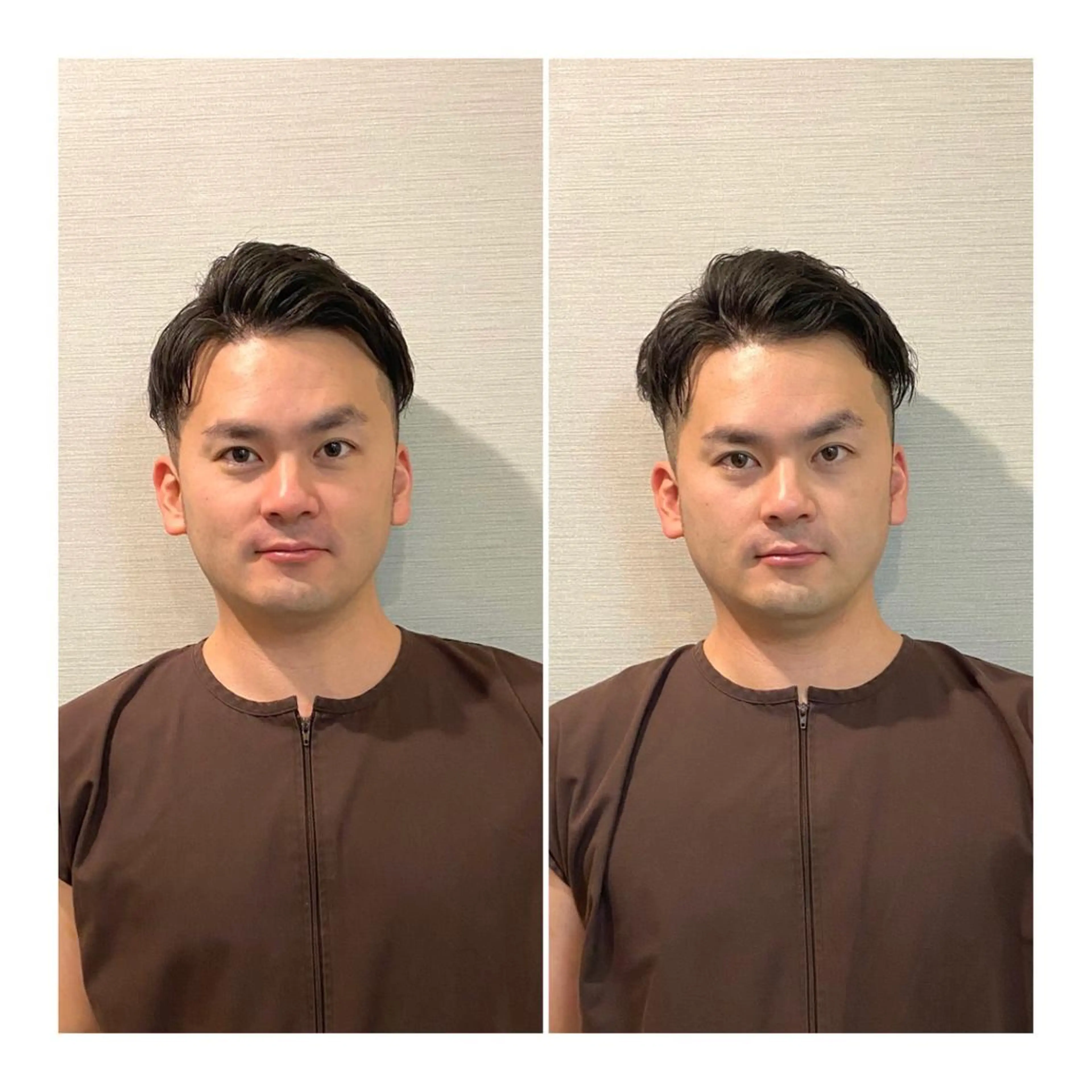 ロング メンズ その他 即小顔♥️美容鍼× ハーブピーリングのその他イメージ