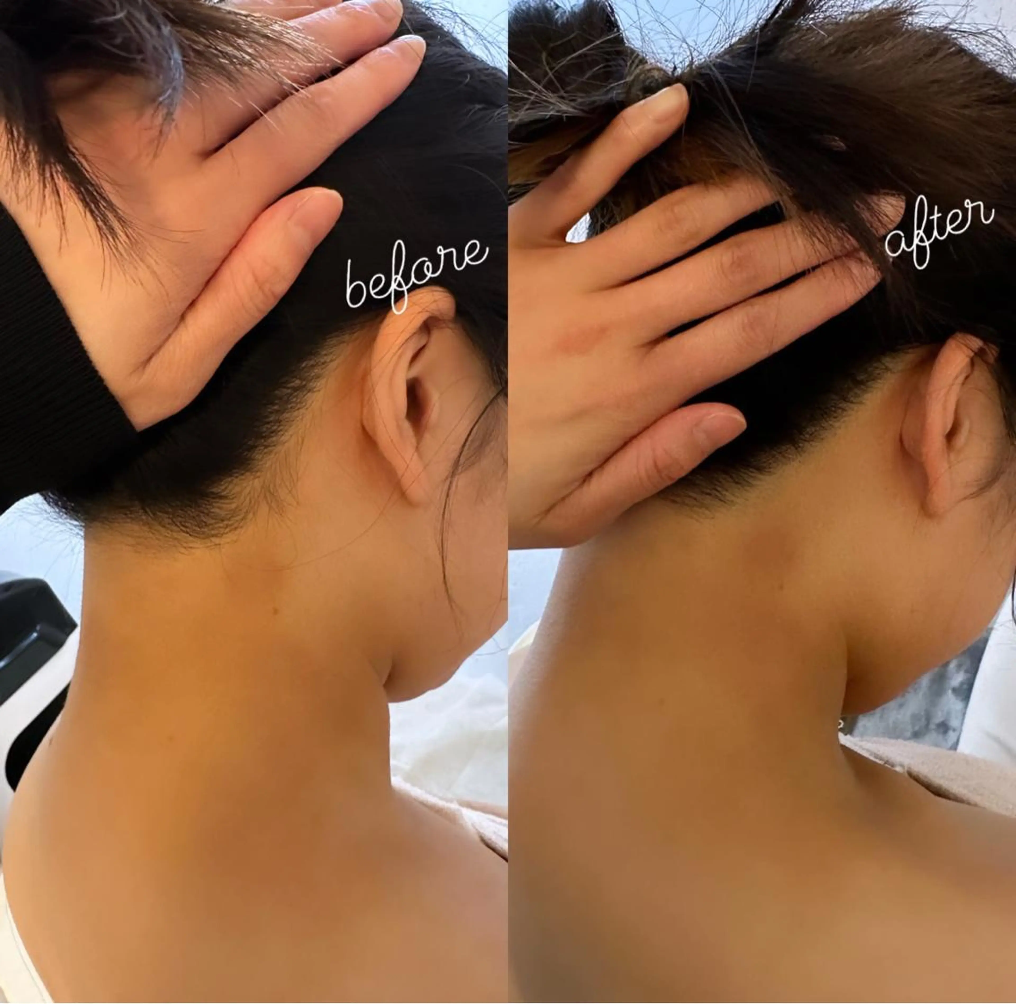 うなじ脱毛/美肌脱毛 LABELのエステ・リラクイメージ