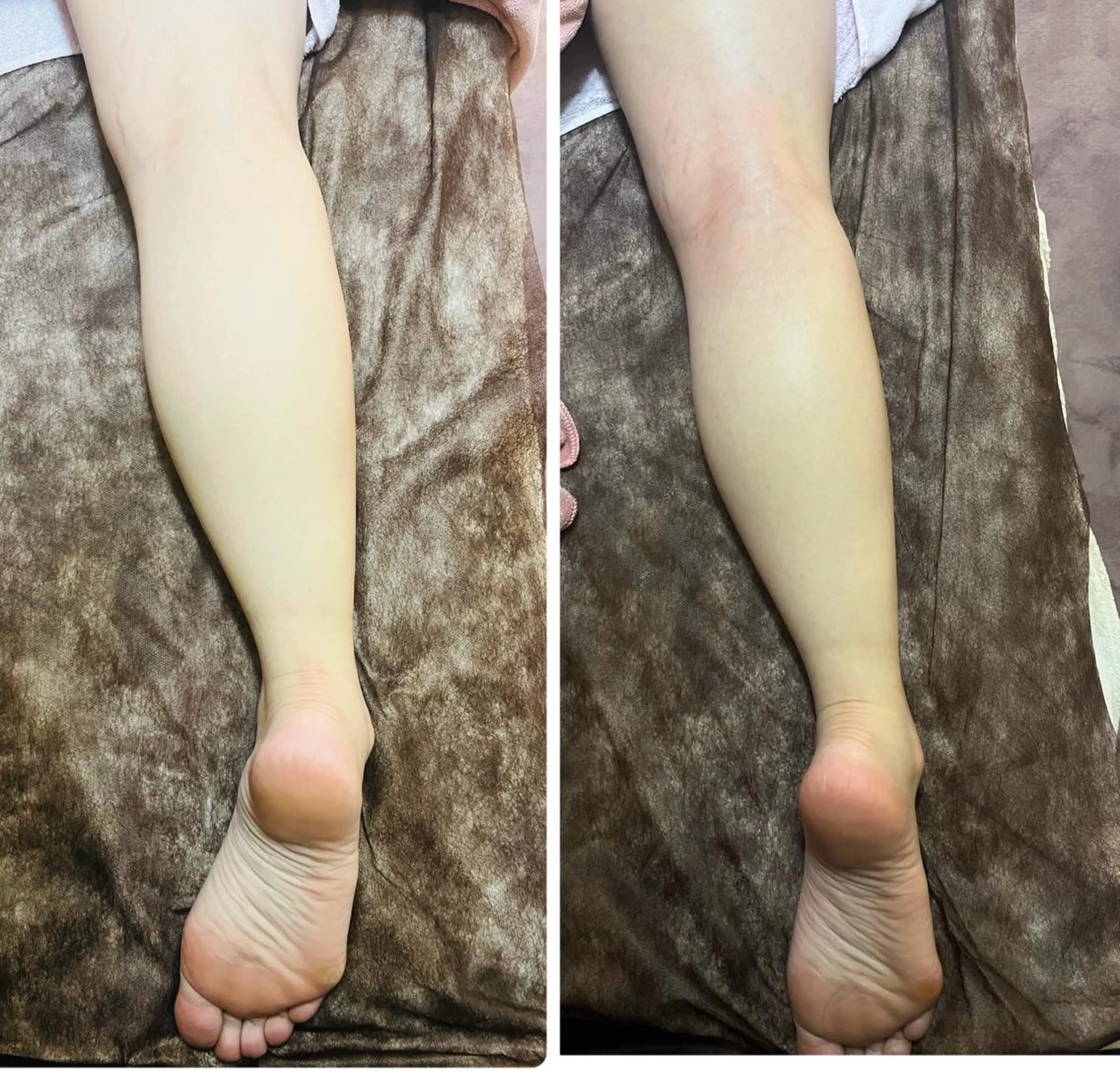 アロマ･美容鍼･カッ ピング「麗」鍼灸院のエステ・リラクイメージ