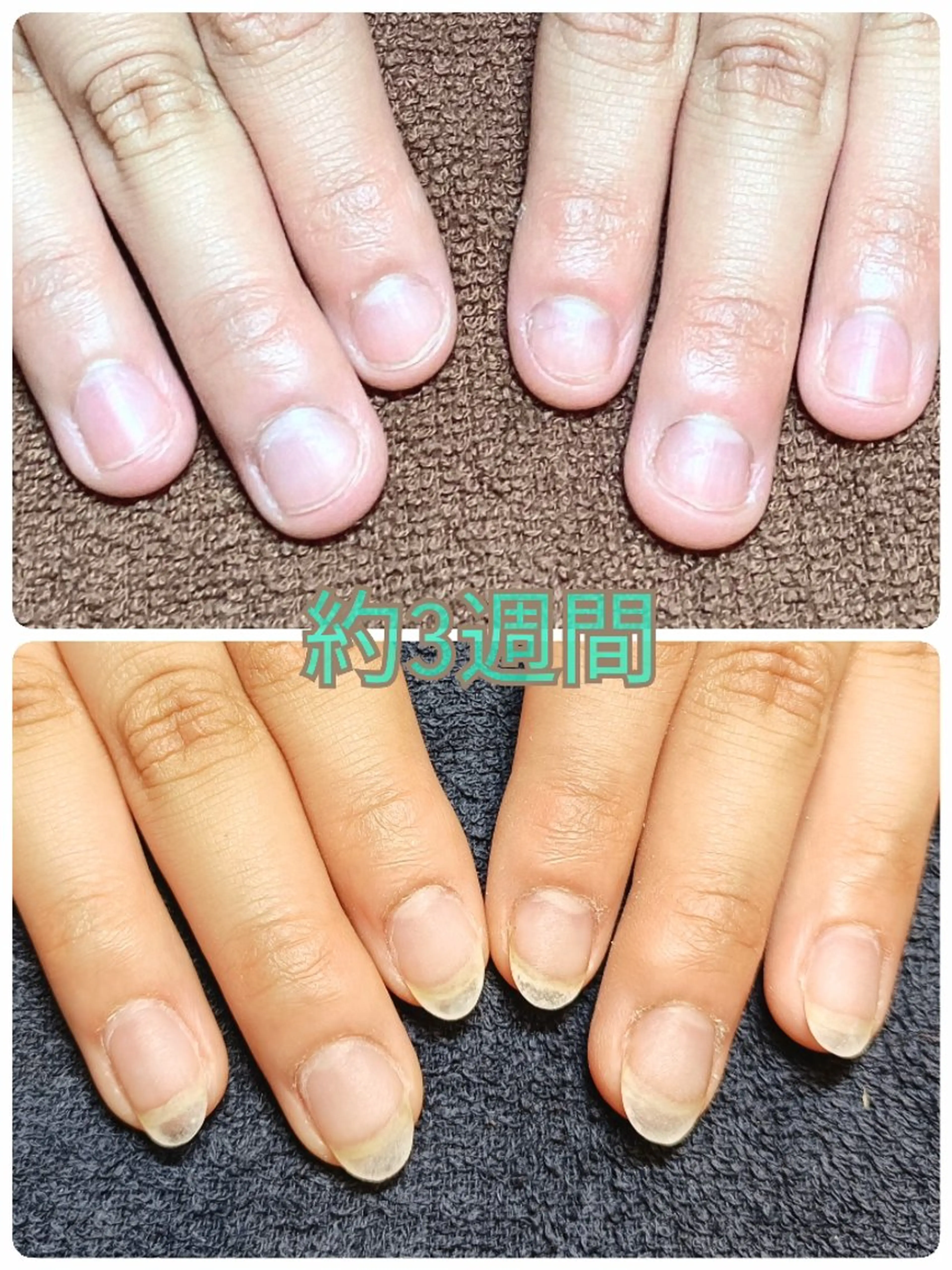 ネイル ハンドネイル ハンドケア 深爪矯正/爪育成ケア manie nailのネイルデザイン
