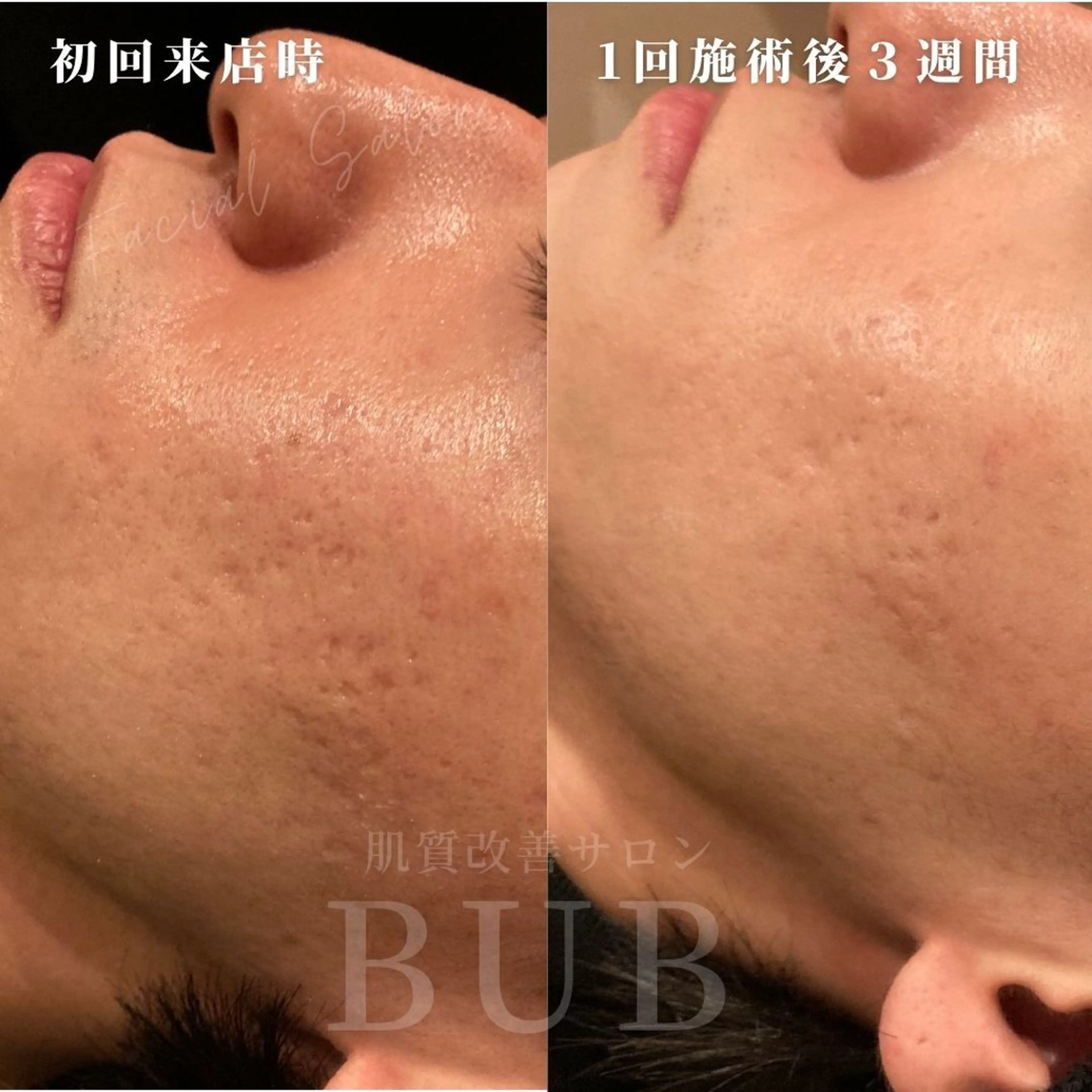 BIB PIBのエステ・リラクイメージ