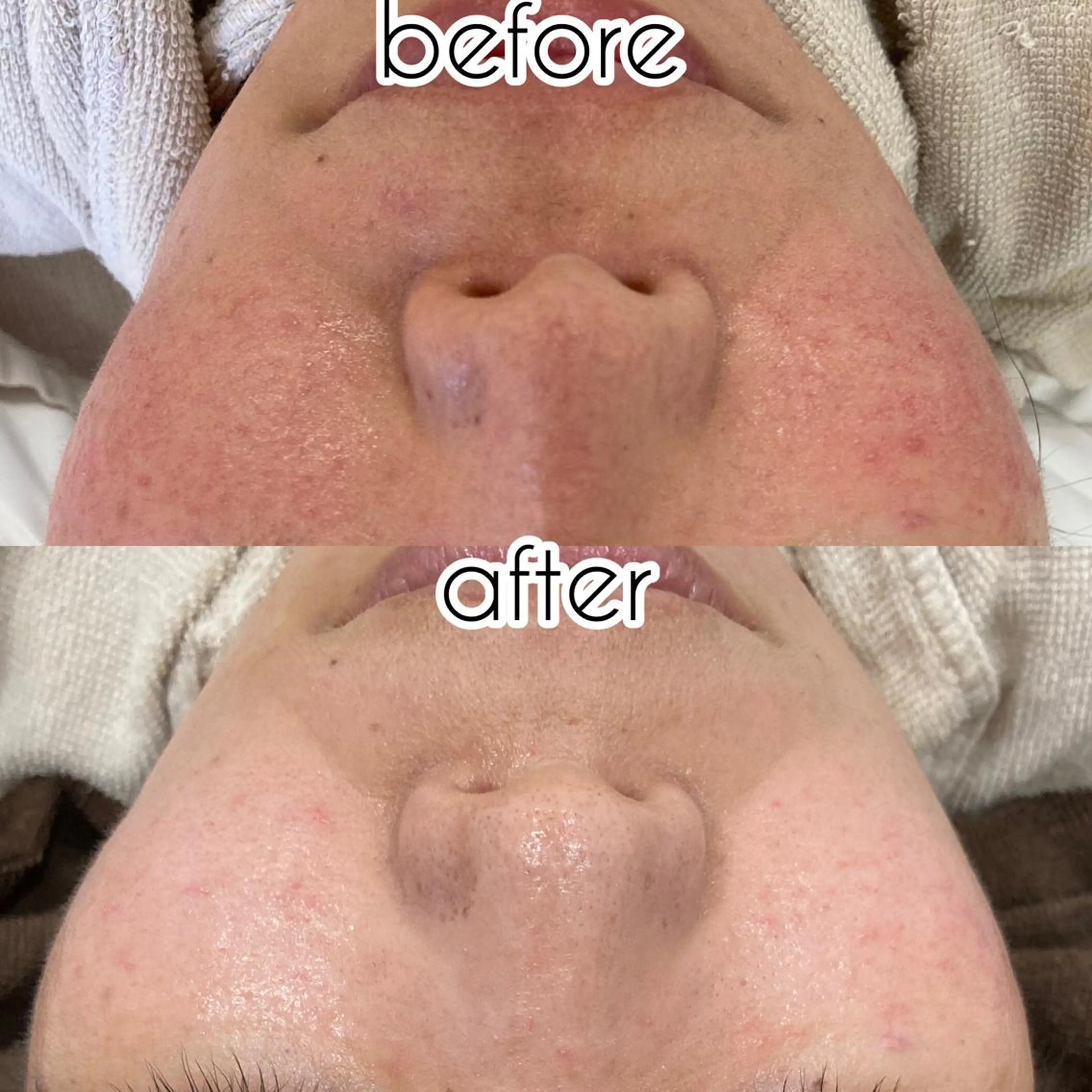 laluna saki...のその他イメージ