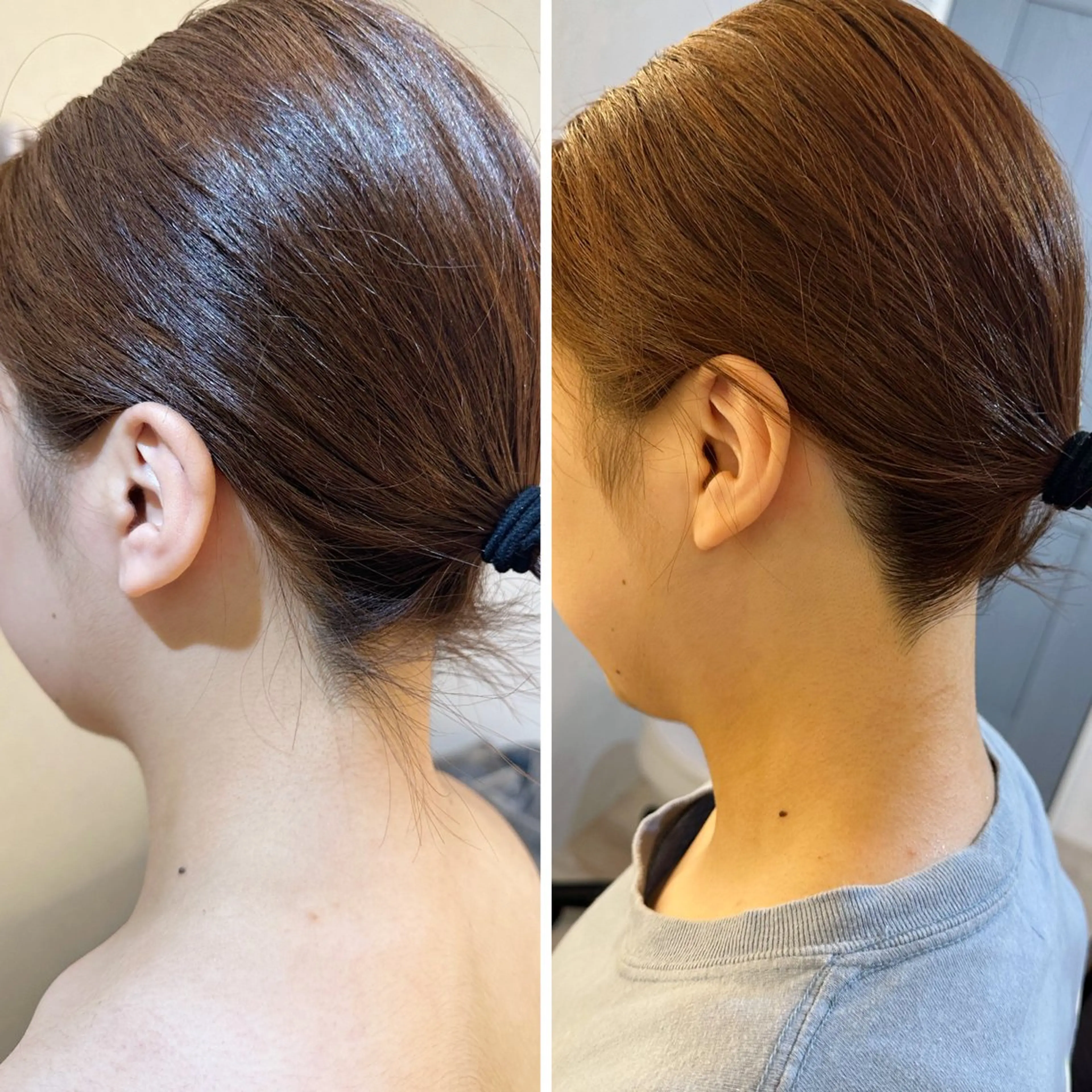 脱毛 うなじ脱毛/美肌脱毛 LABELのエステ・リラクイメージ