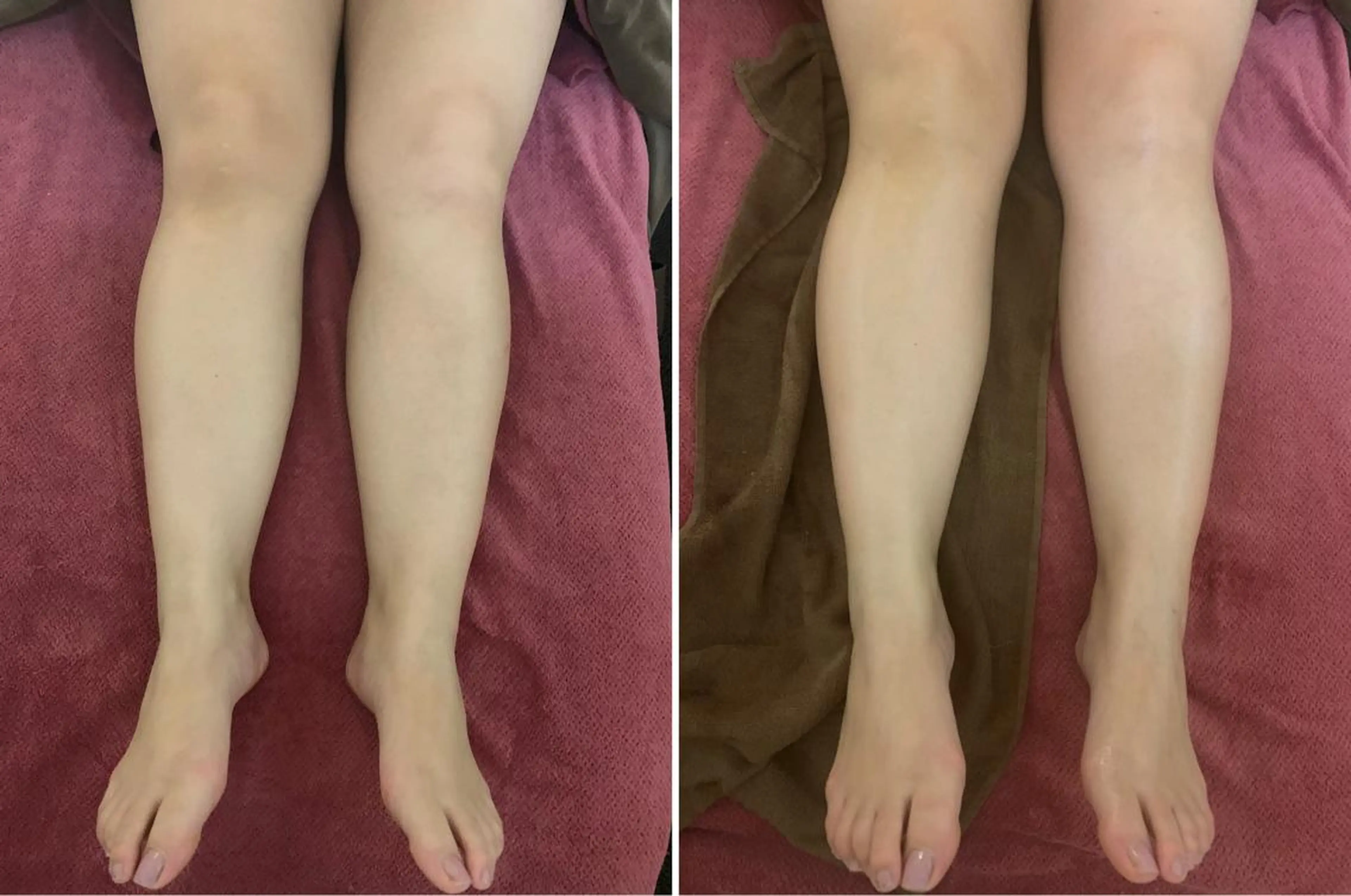 バストケア RAYVIS梅田店Nのエステ・リラクイメージ