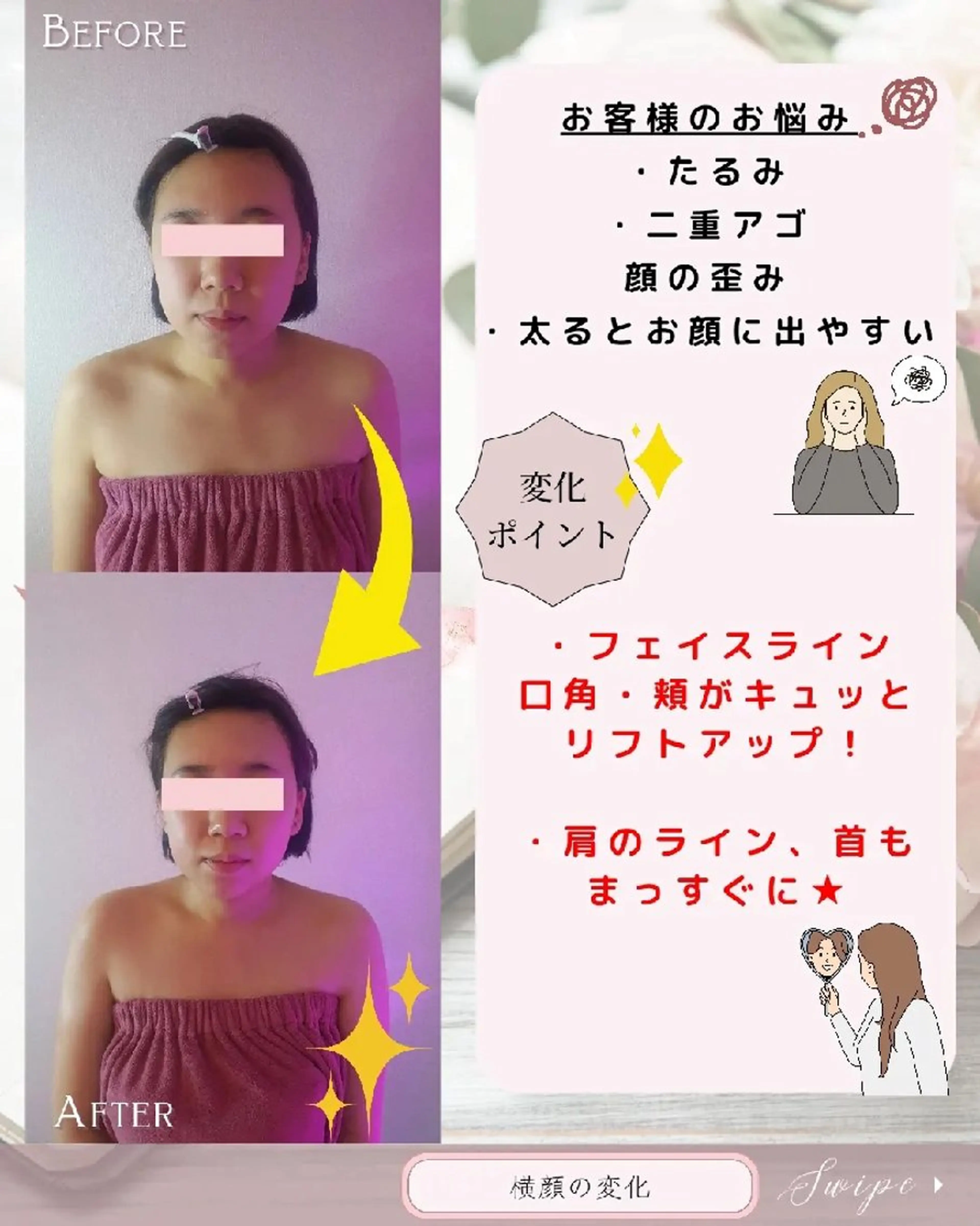 痩身ハーブピーリング 筋膜リリース☆B&Hのエステ・リラクイメージ