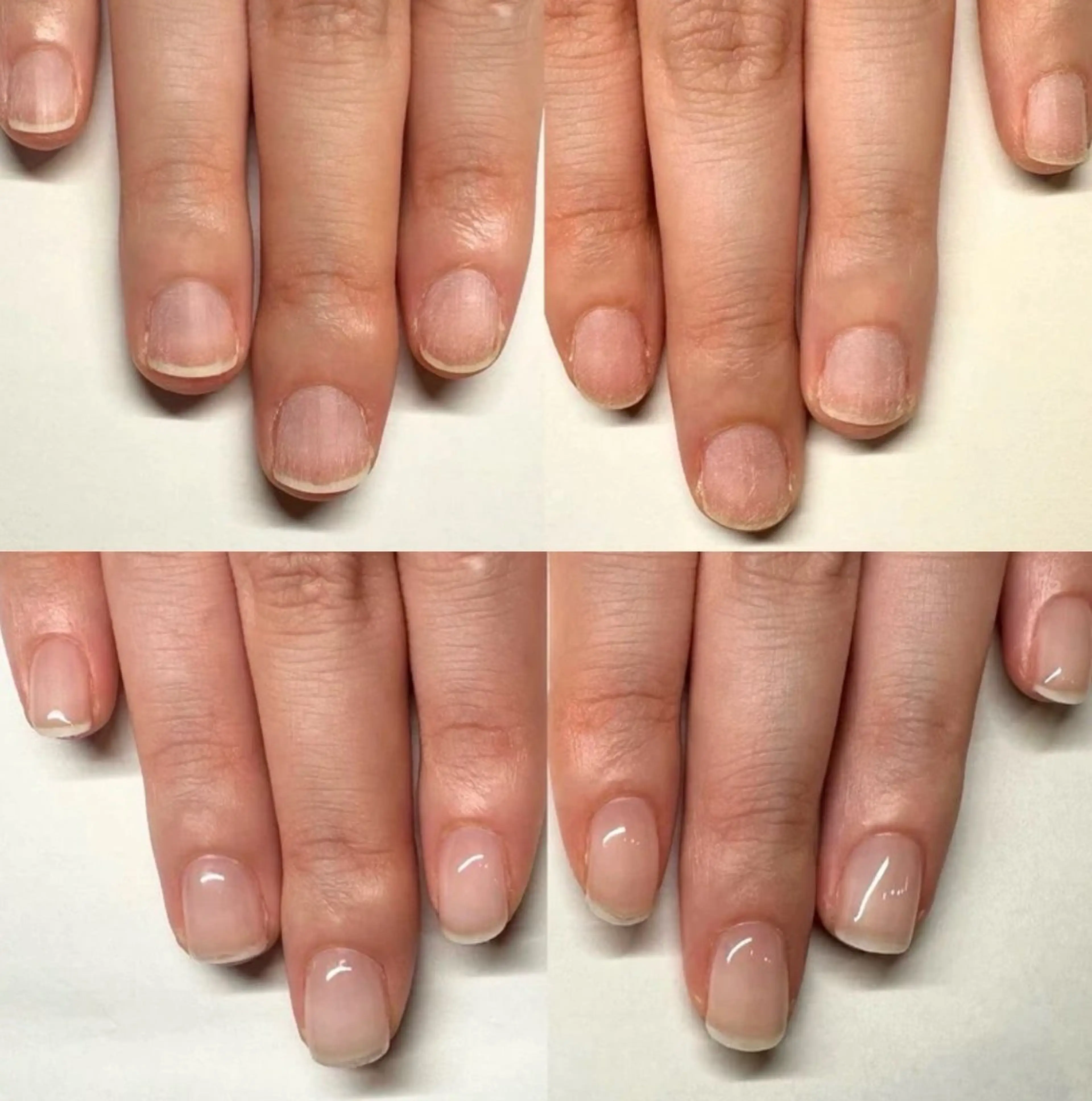 ネイル 深爪矯正専門店ネイルサロンKUU所属・深爪矯正専門店 ネイルサロンKUUのネイルデザイン