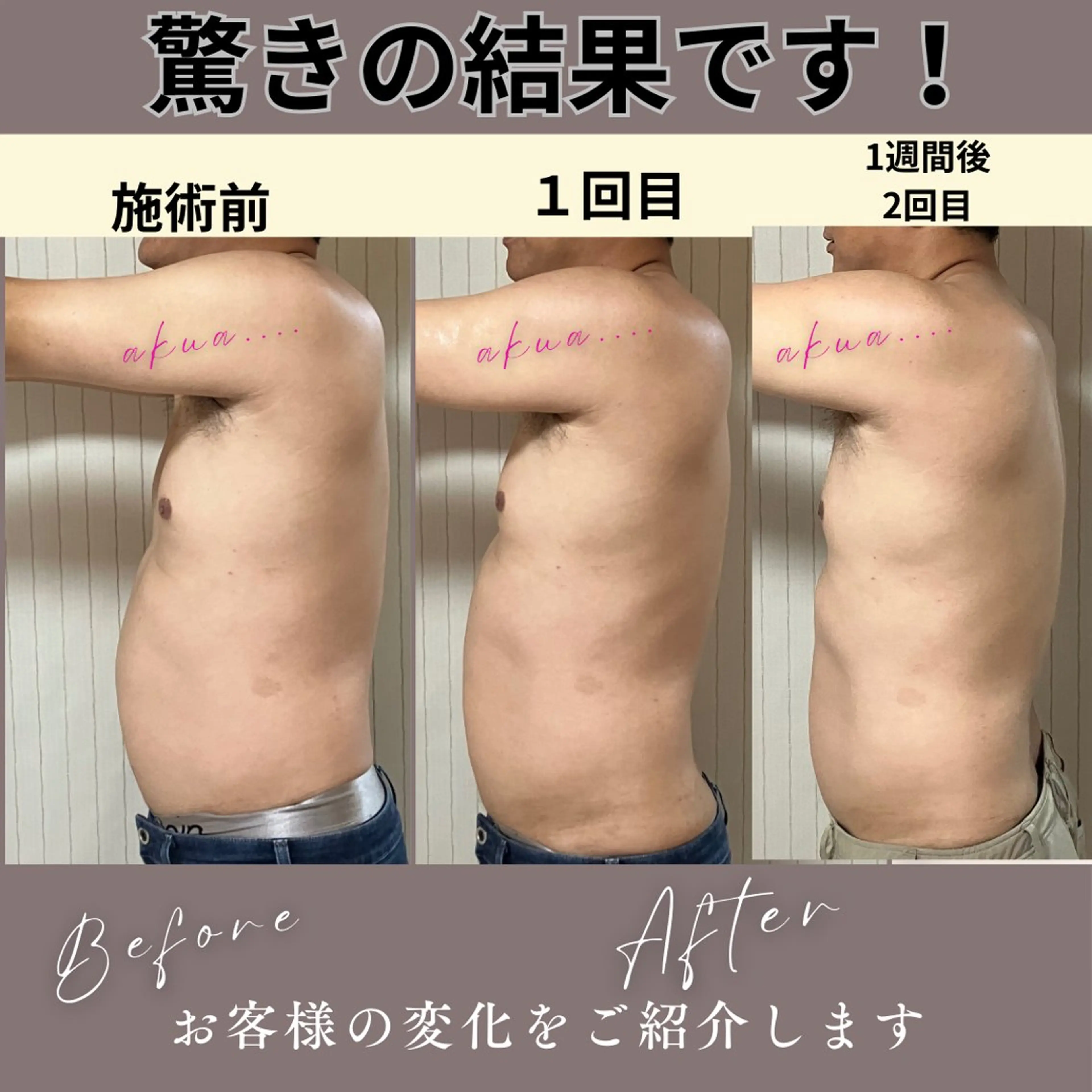 エステ akua... 【肌質管理専門】のその他イメージ