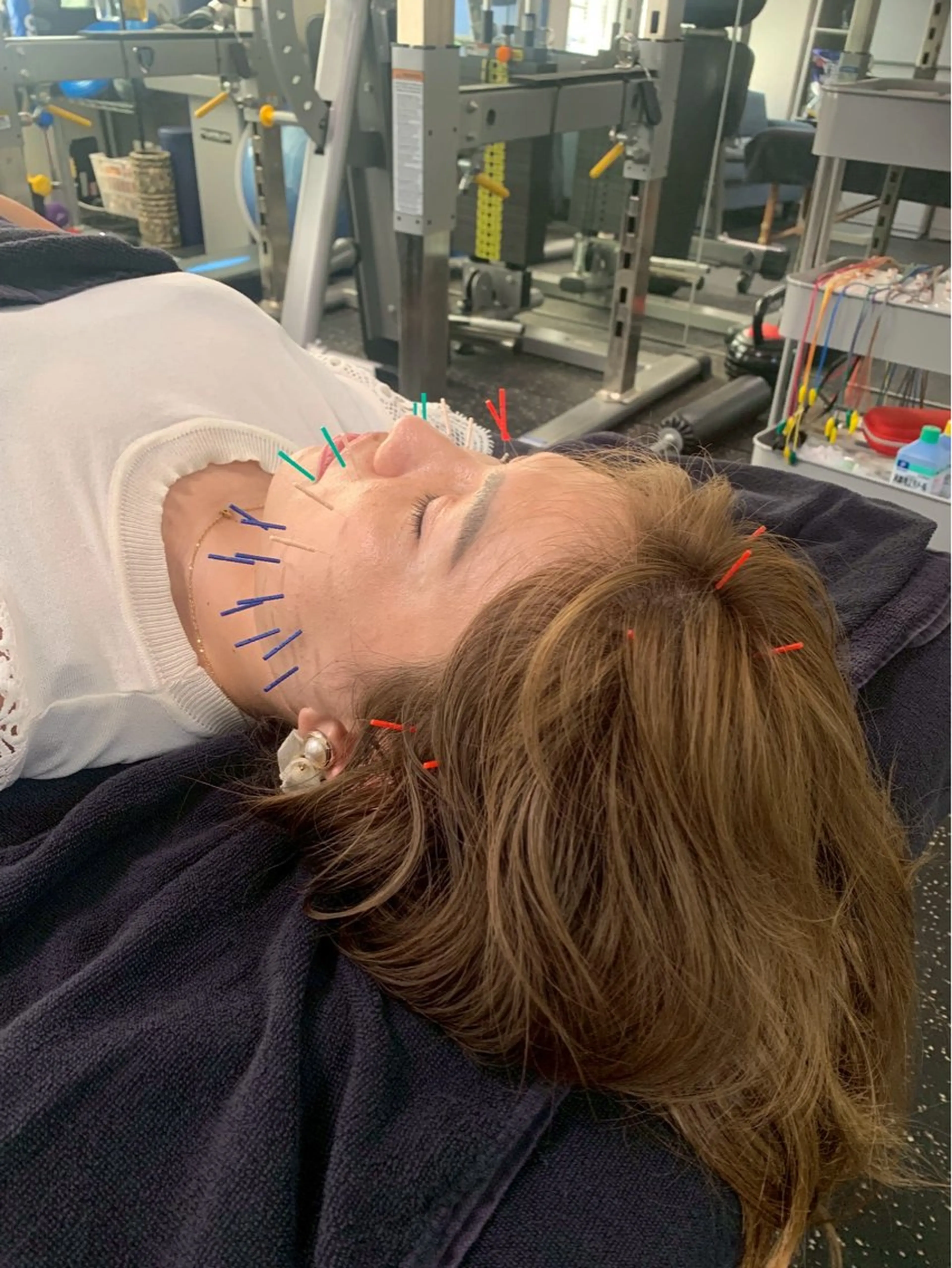 美容鍼・小顔矯正 FLOW 鍼灸整体院のその他イメージ