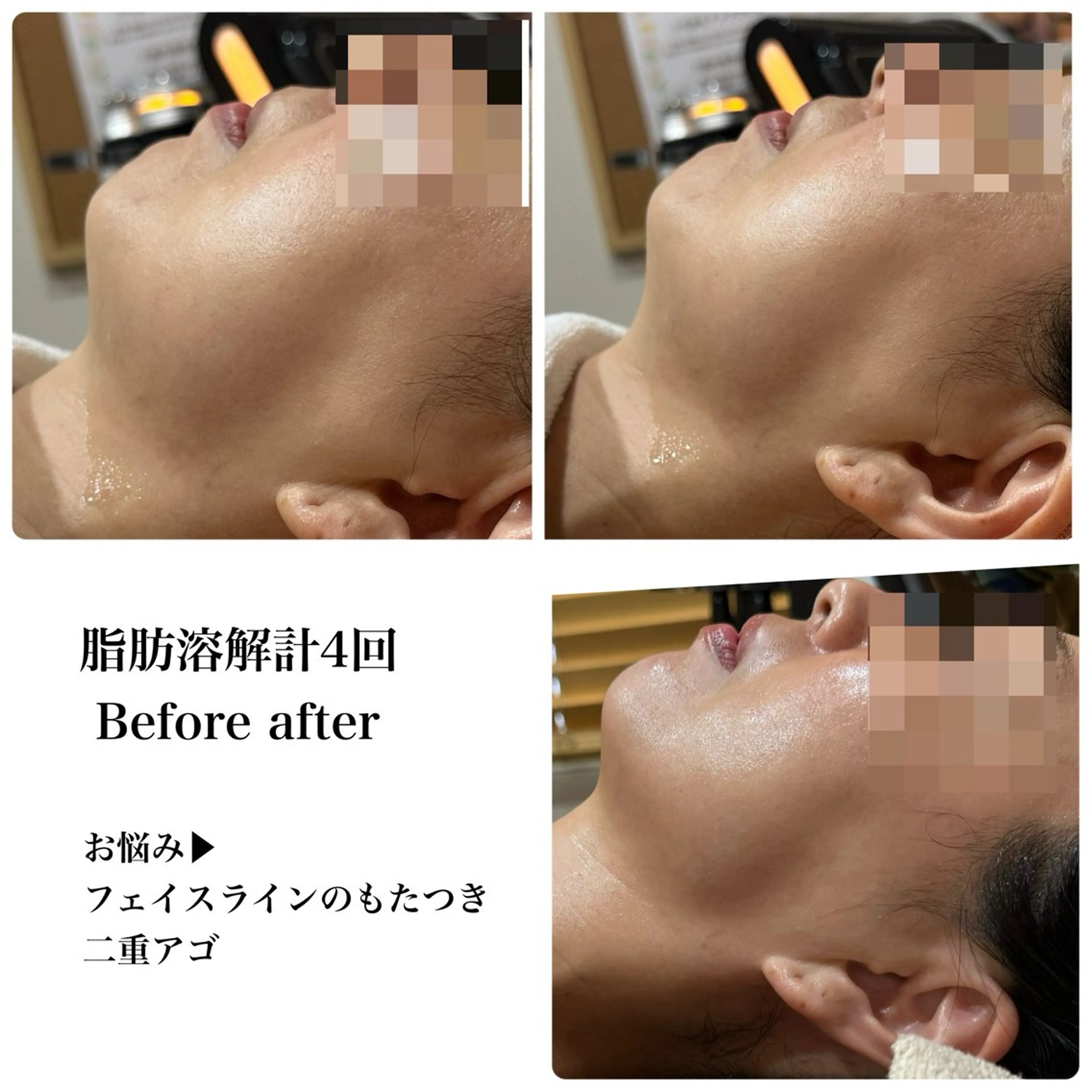 脱毛&フェイシャル 専門店muro.のエステ・リラクイメージ