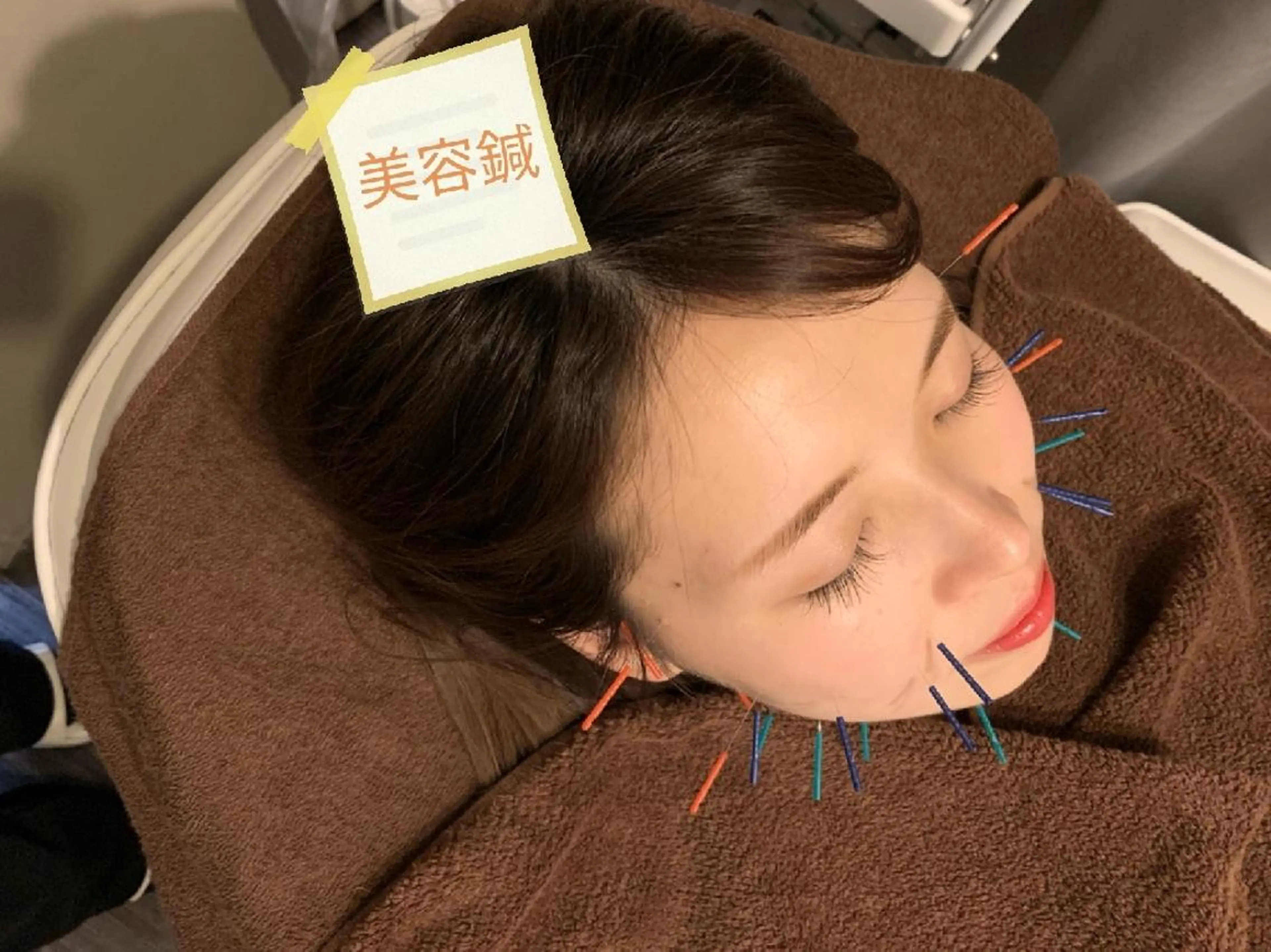 たるみ専門美容鍼 × 猫背整体 のぐち所属・小顔と姿勢改善のプロ ｜整体と美容鍼のぐちのエステ・リラクイメージ