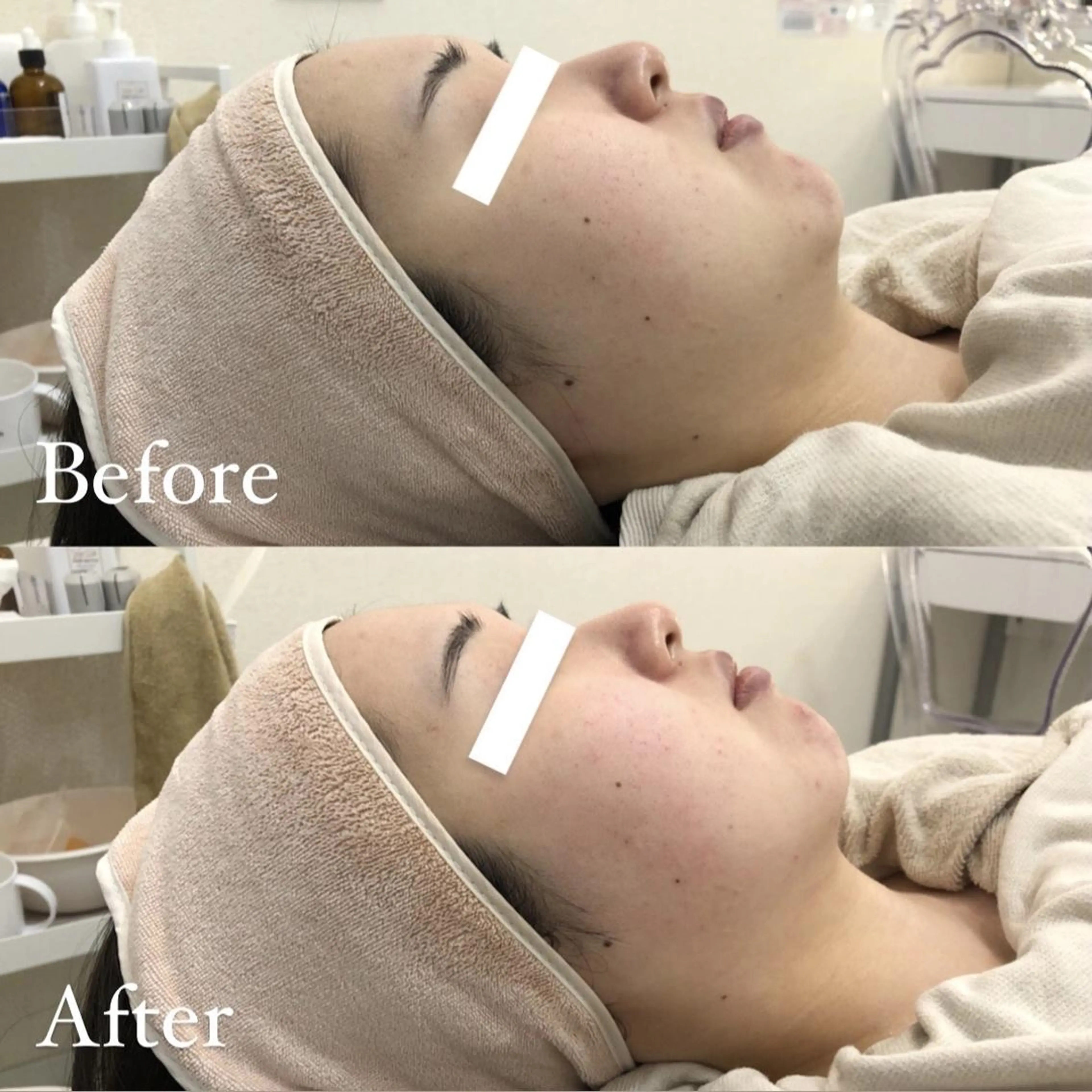 ショート 小顔カット ✨美肌水光✨ アトリエリュバンのエステ・リラクイメージ